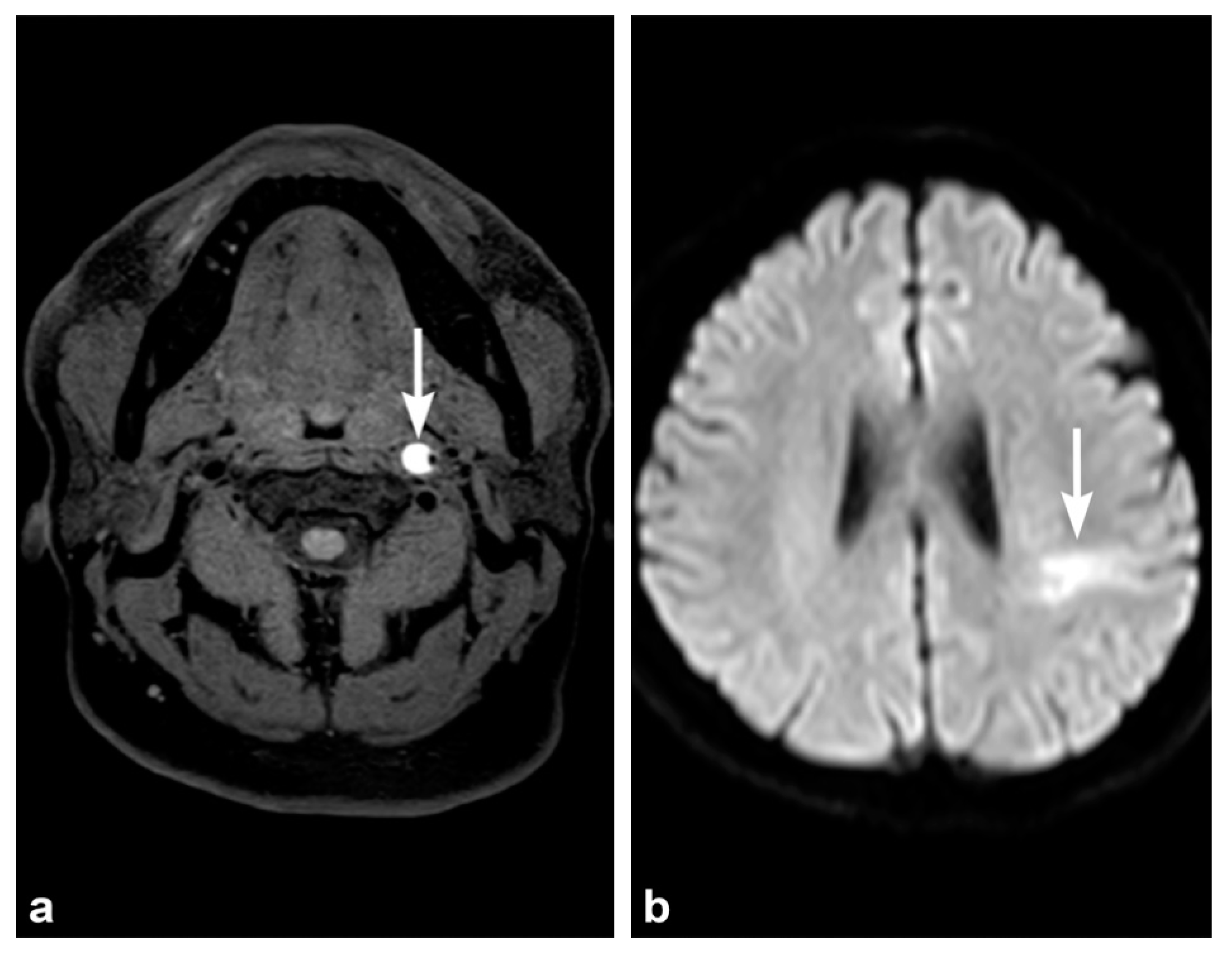 Tomography 08 00033 g006 Tomography 08 00033 g006