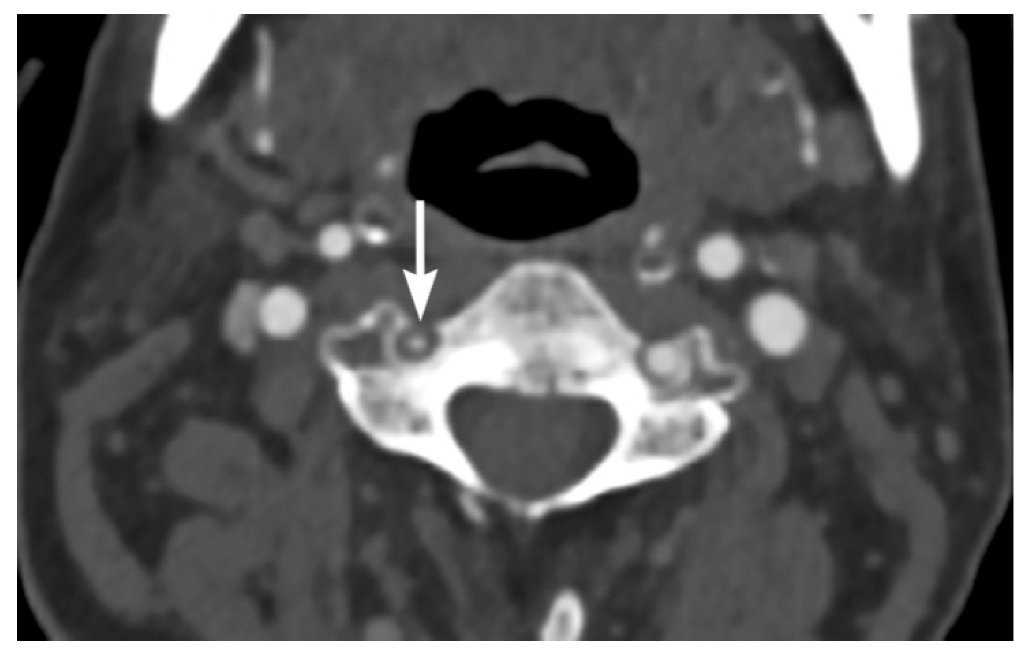 Tomography 08 00033 g007 Tomography 08 00033 g007