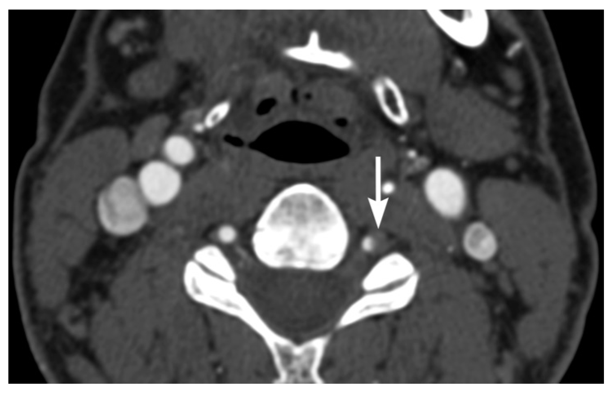 Tomography 08 00033 g008 Tomography 08 00033 g008