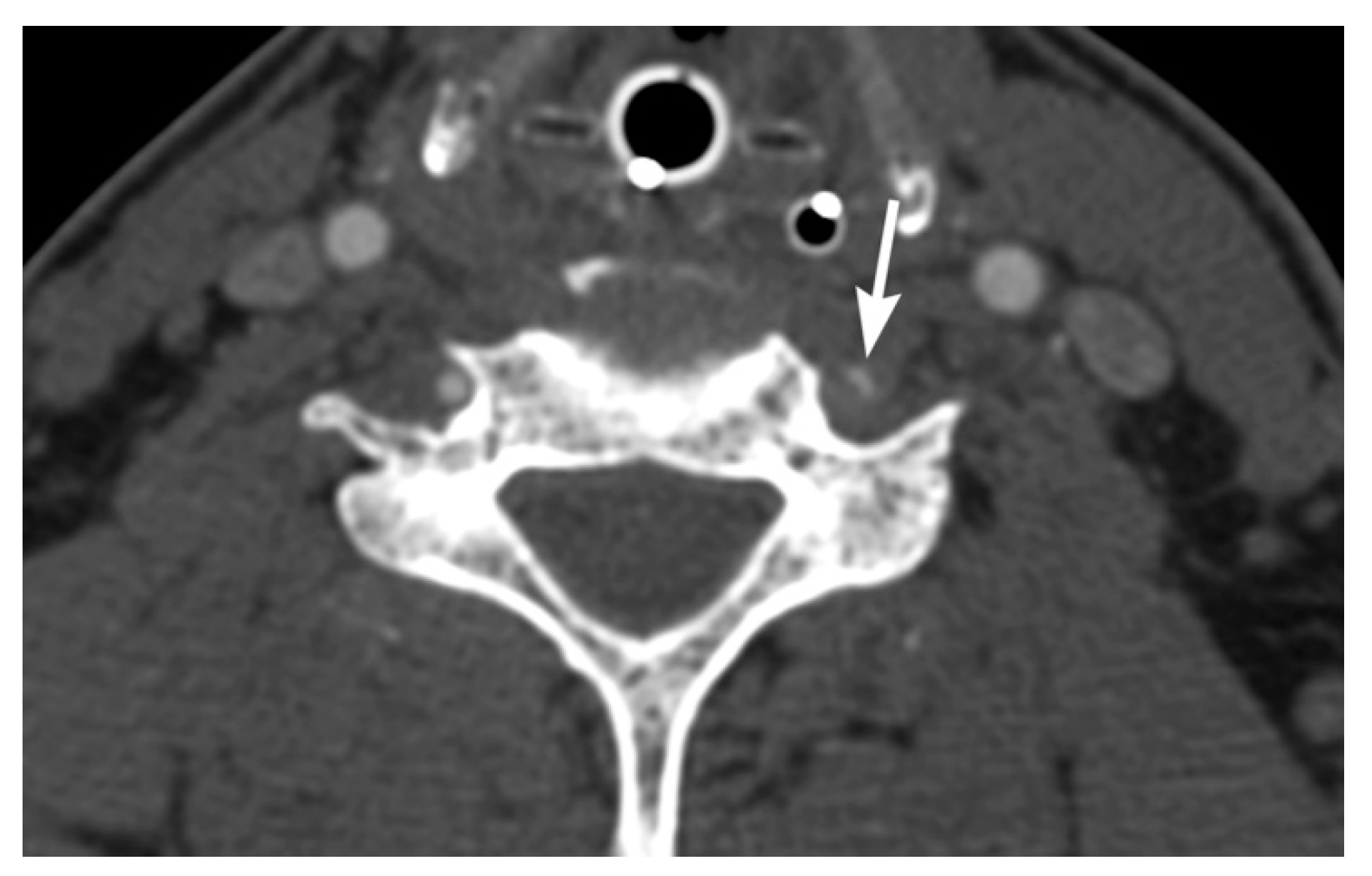 Tomography 08 00033 g009 Tomography 08 00033 g009