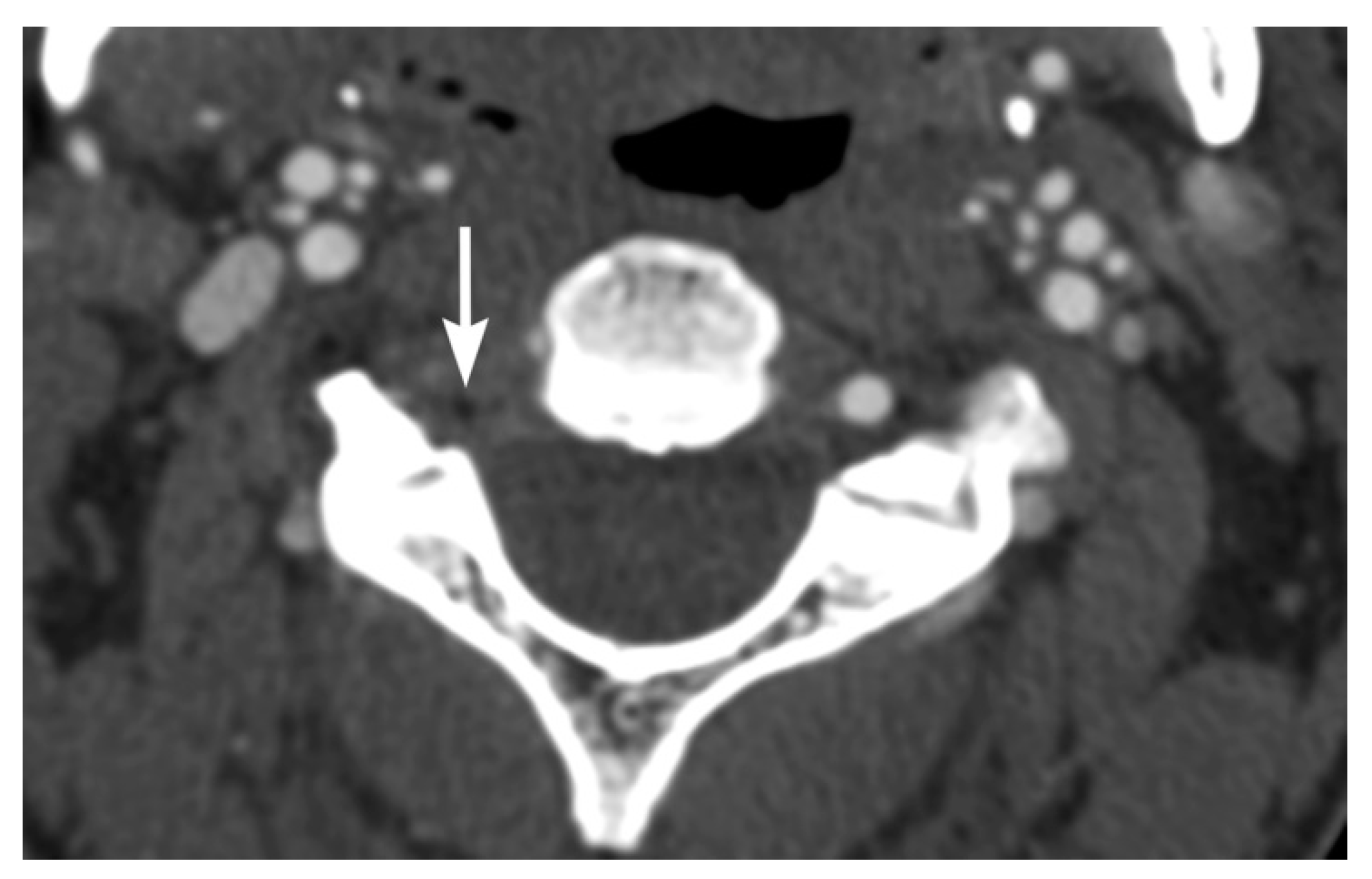 Tomography 08 00033 g010 Tomography 08 00033 g010