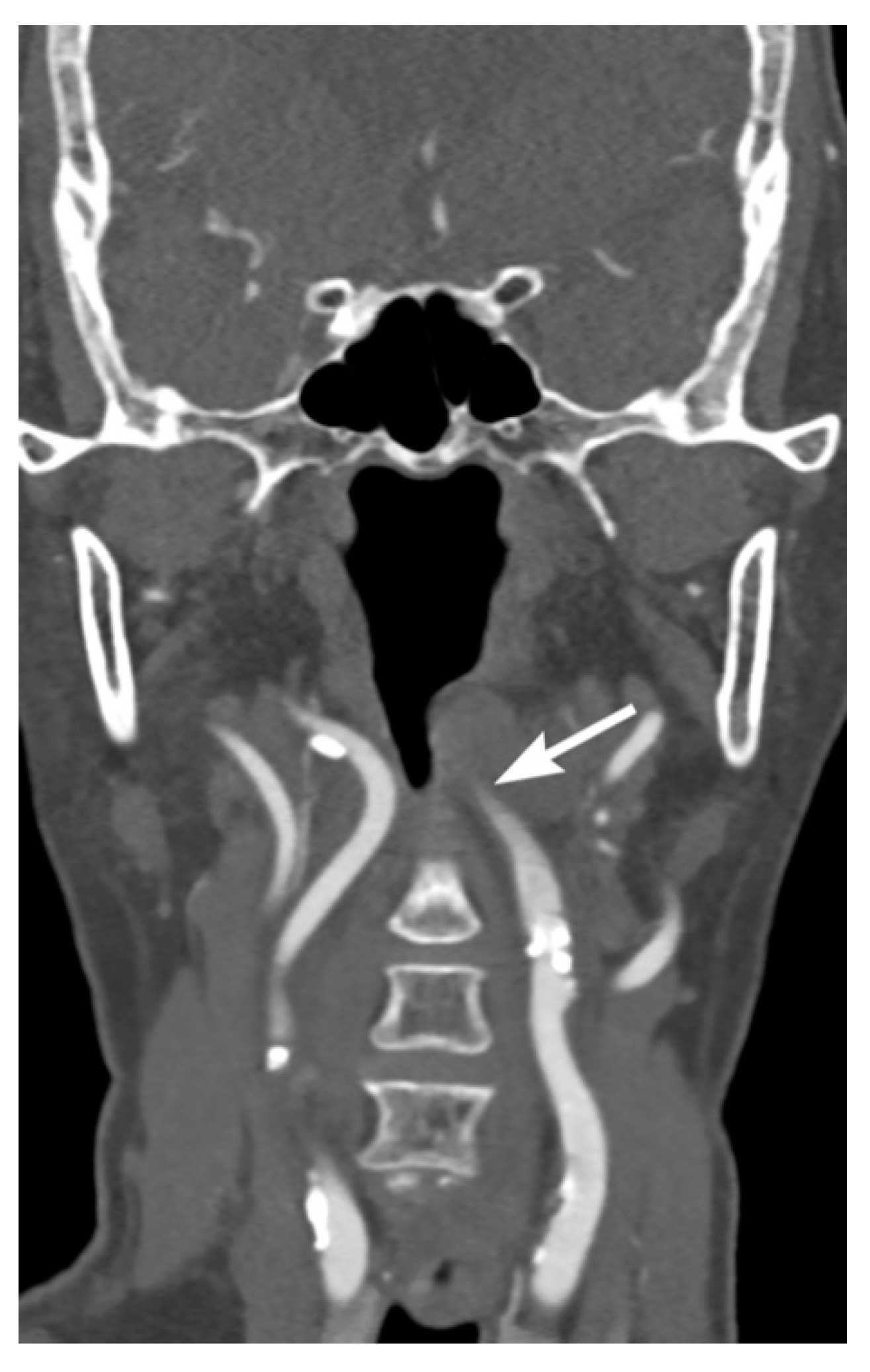 Tomography 08 00033 g011 Tomography 08 00033 g011