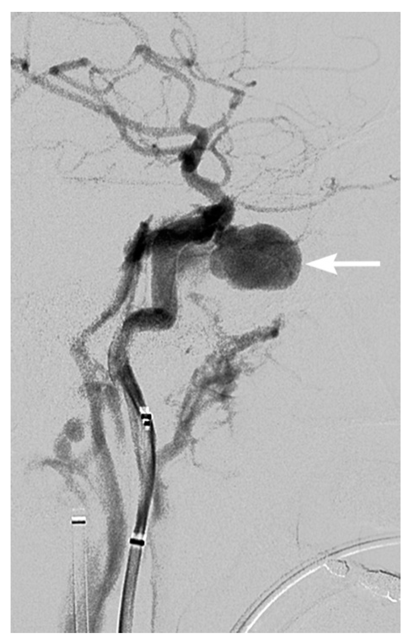 Tomography 08 00033 g013 Tomography 08 00033 g013