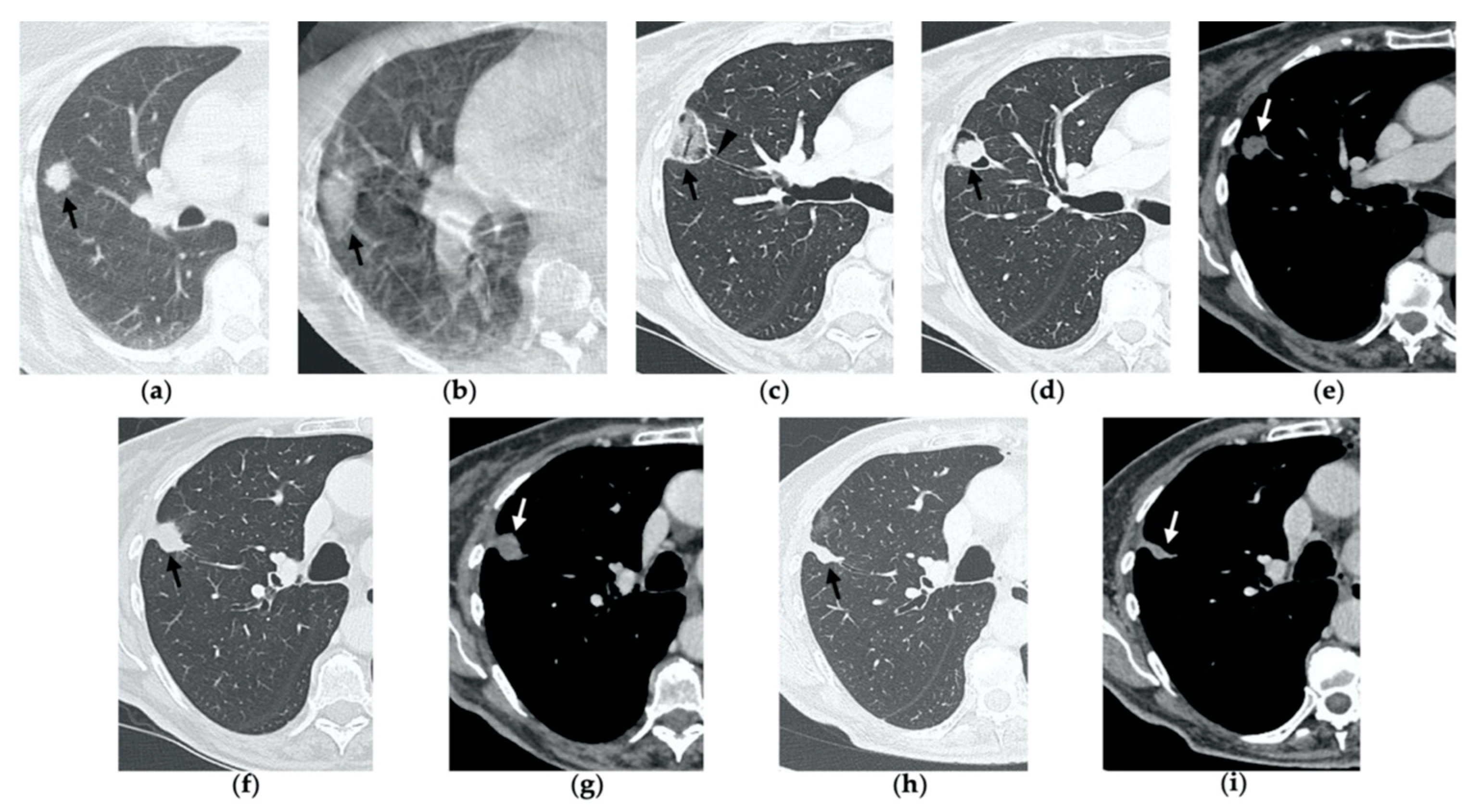 Tomography 08 00051 g002