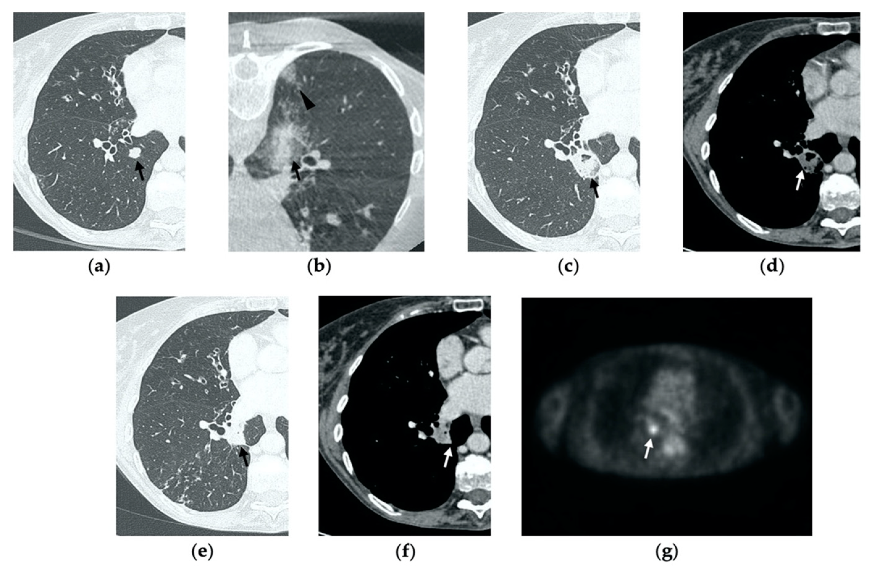 Tomography 08 00051 g005