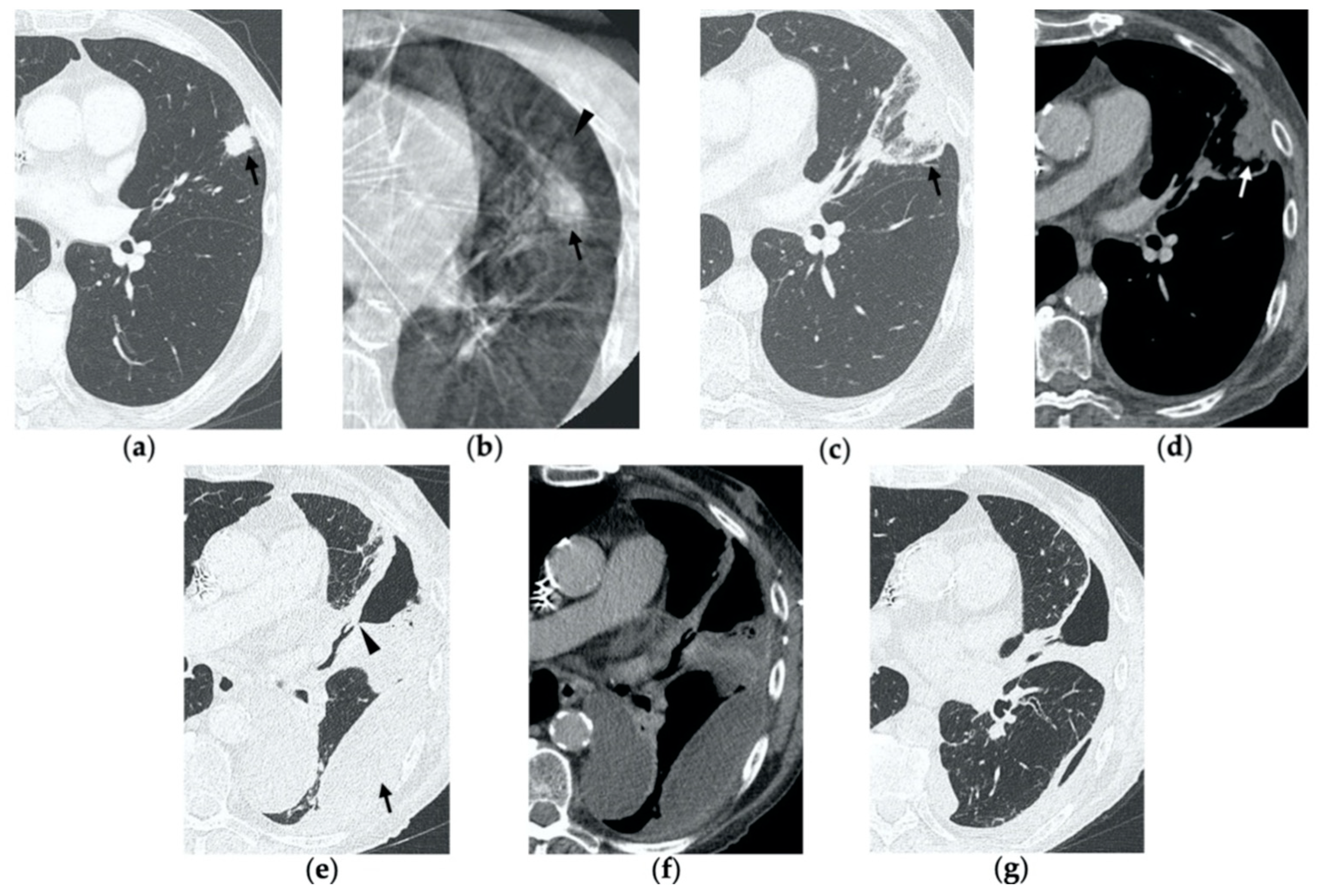 Tomography 08 00051 g006