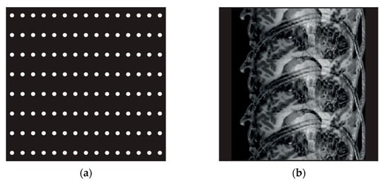 Cerebral Magnetic Resonance Imaging sequence Turbo Spin Eco Sense