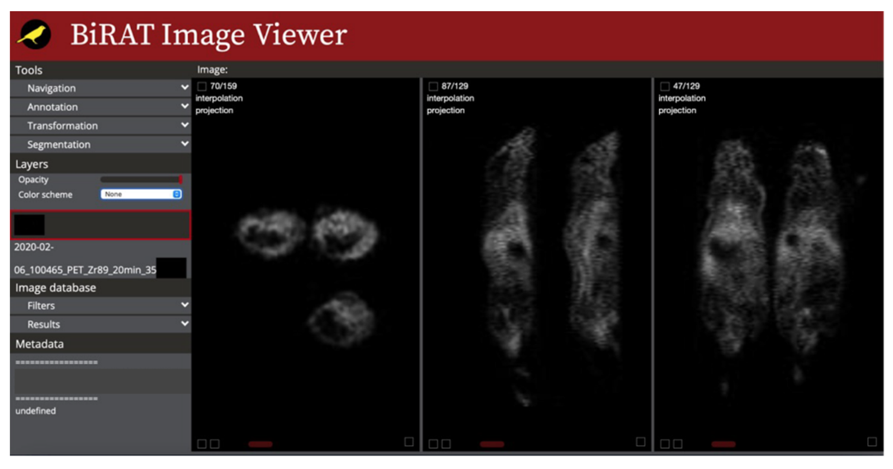 Tomography 08 00117 g005 Tomography 08 00117 g005