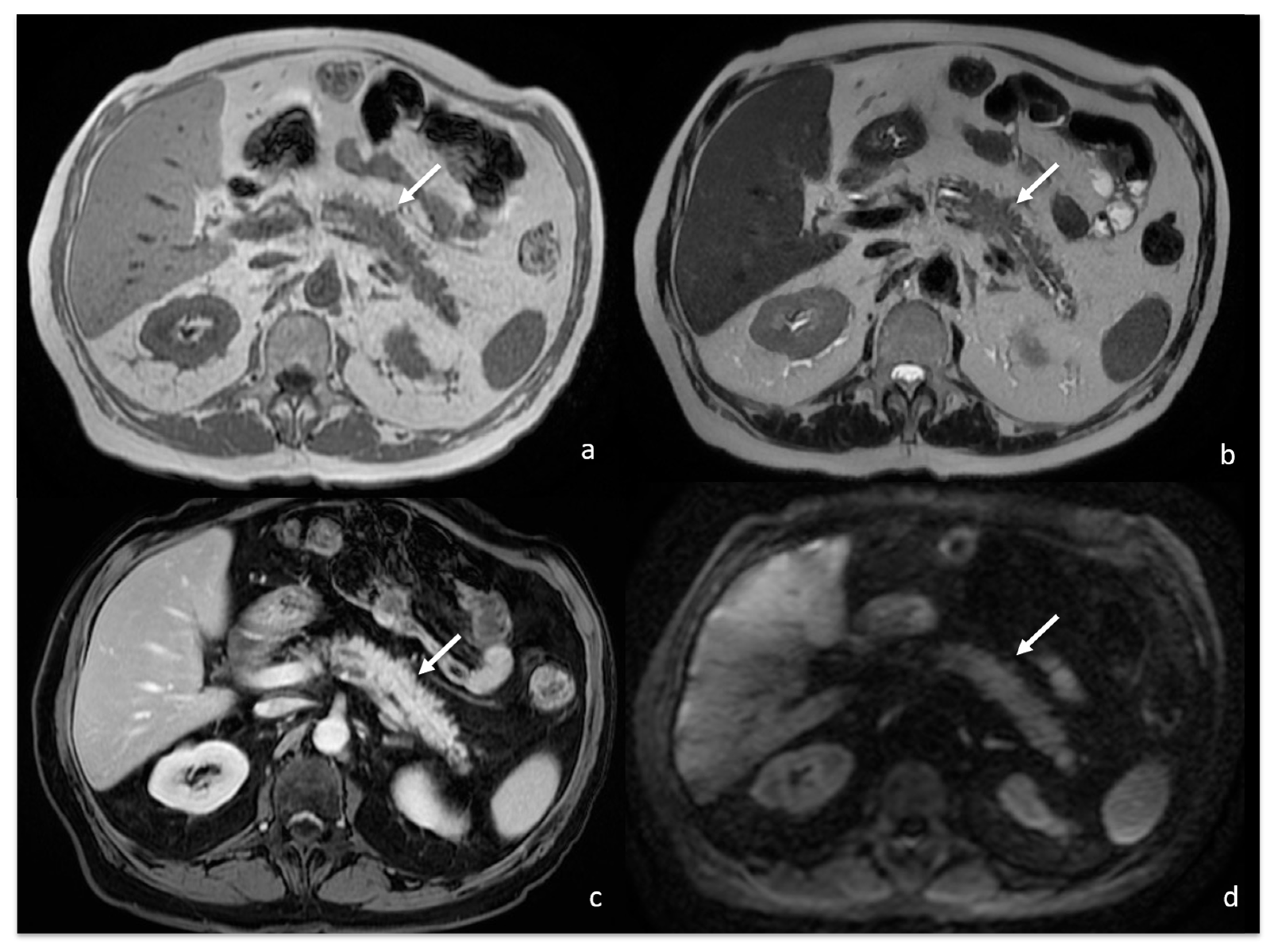 Tomography 08 00174 g007