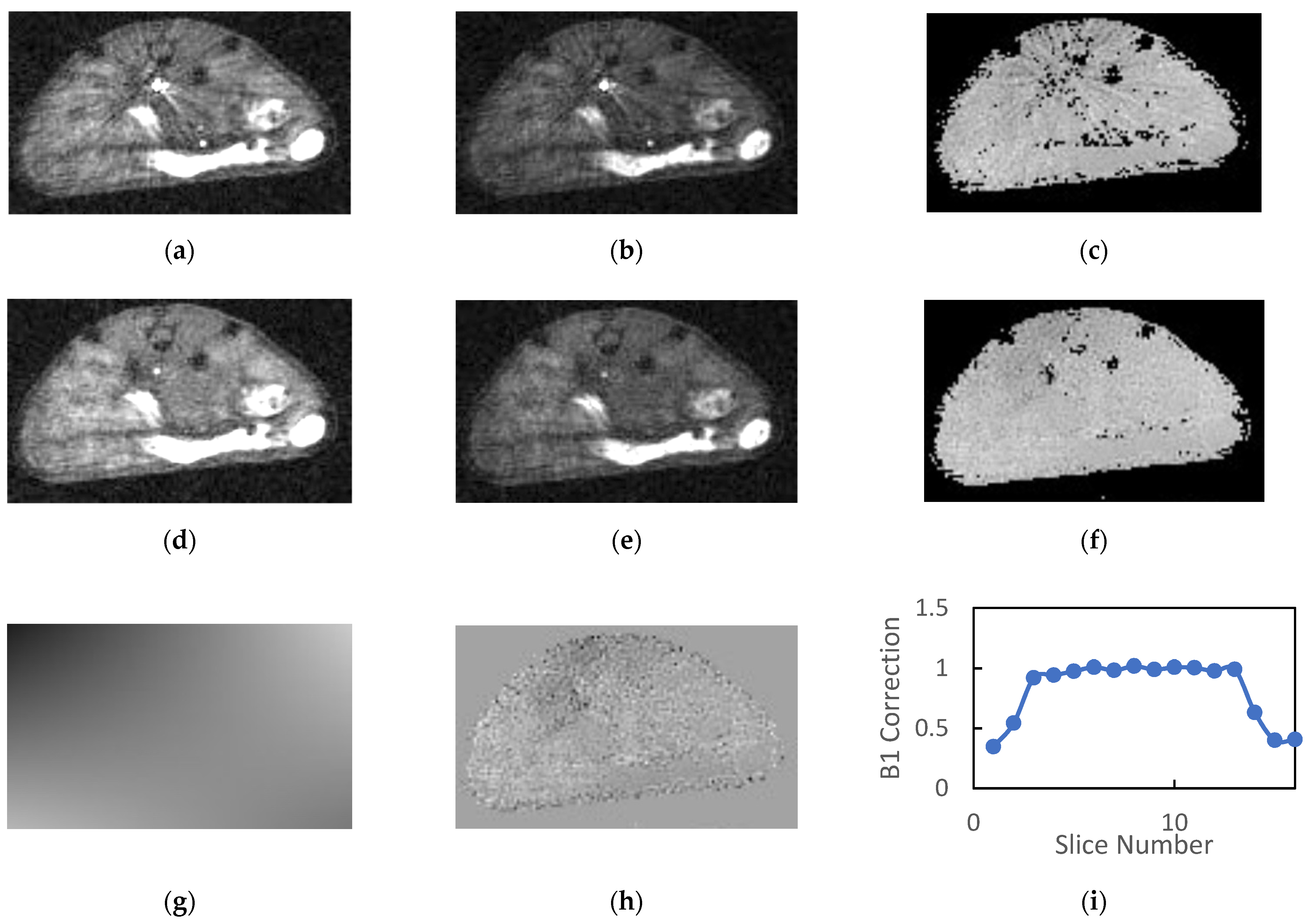Tomography | Free Full-Text | Dynamic Contrast-Enhanced MRI in the Abdomen  of Mice with High Temporal and Spatial Resolution Using Stack-of-Stars  Sampling and KWIC Reconstruction | HTML