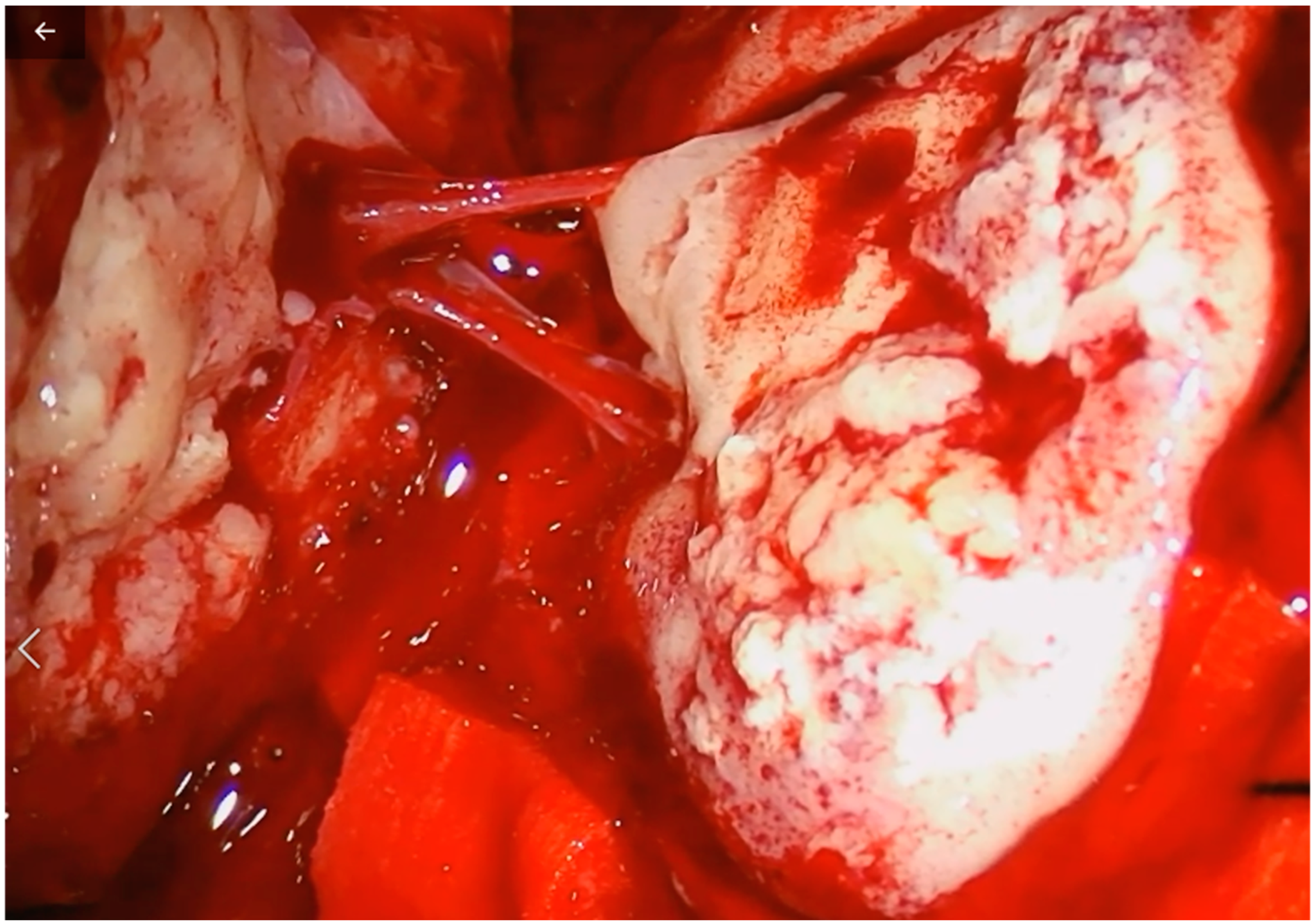 Tomography 08 00181 g002 Tomography 08 00181 g002