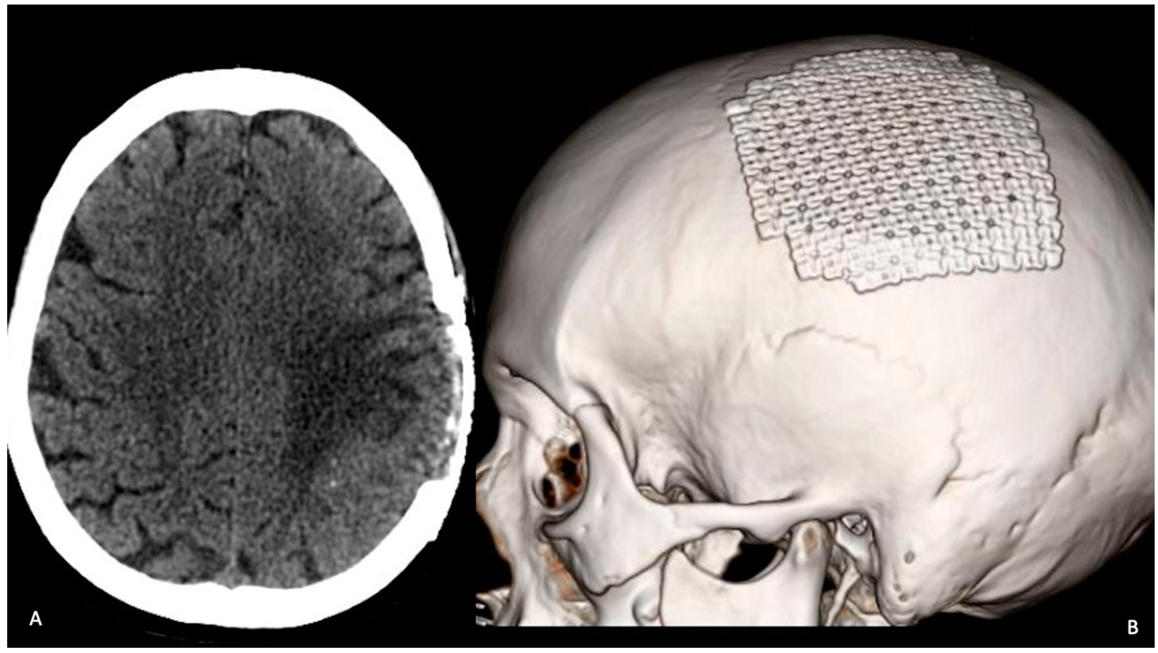 Tomography 08 00181 g004 Tomography 08 00181 g004