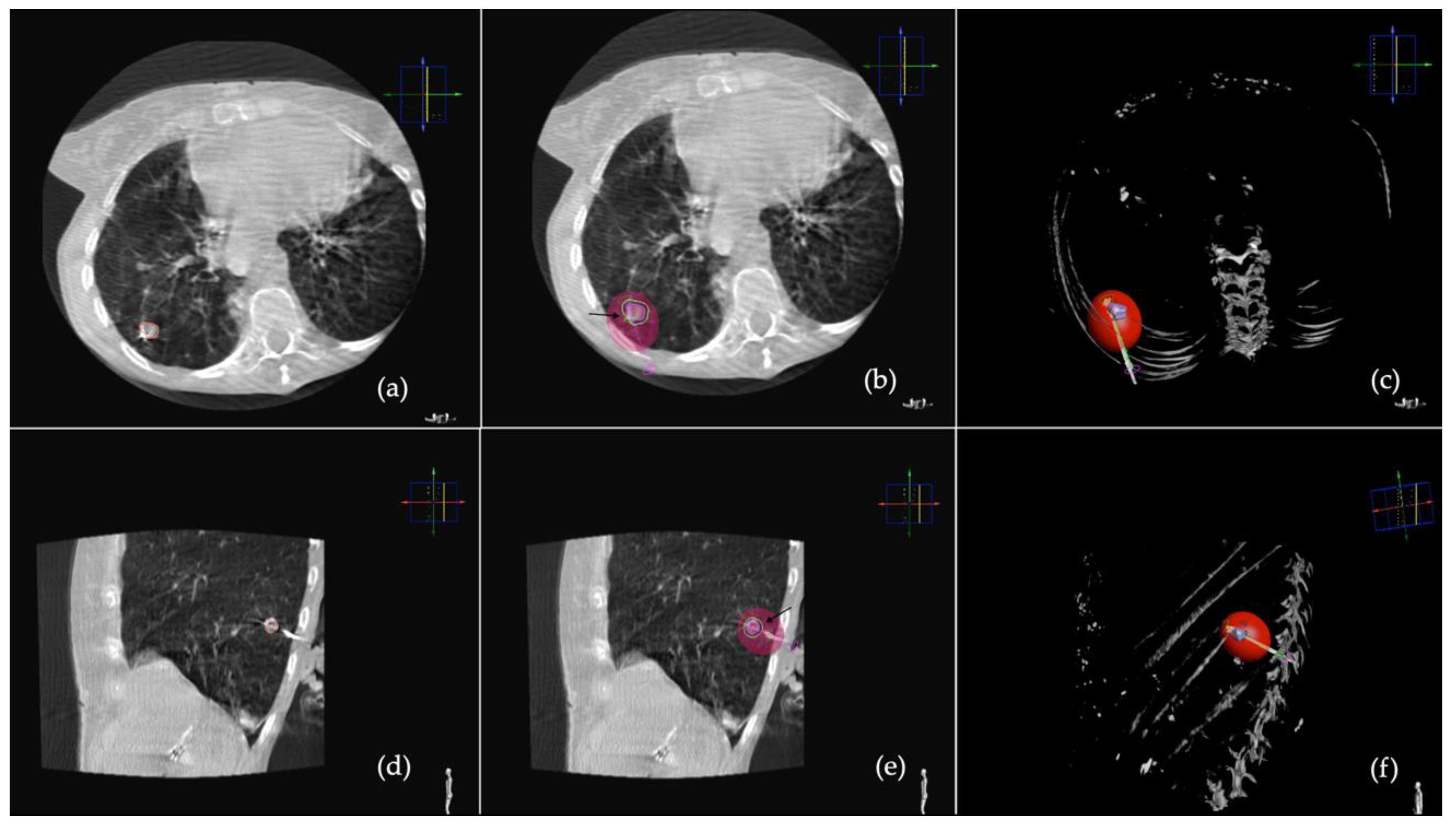 Tomography 08 00206 g001
