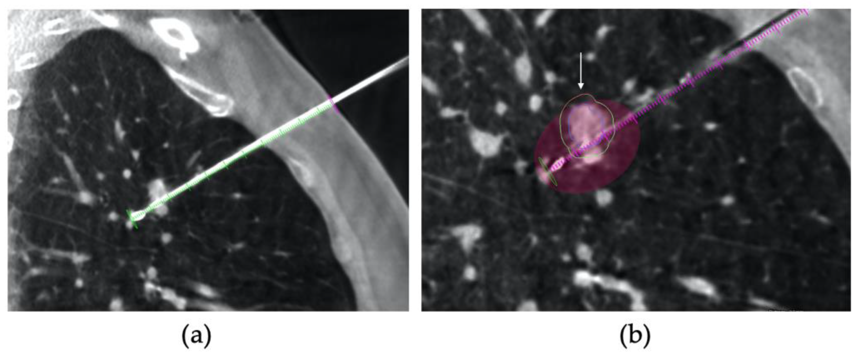 Tomography 08 00206 g002