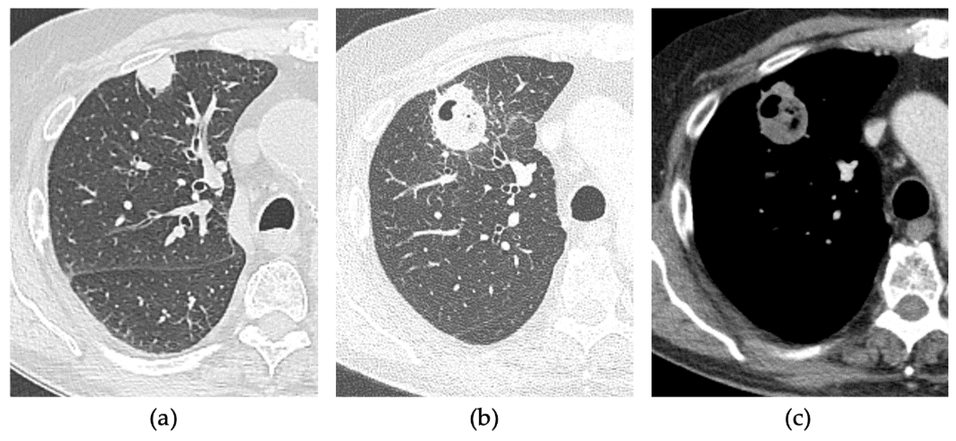 Tomography 08 00206 g005