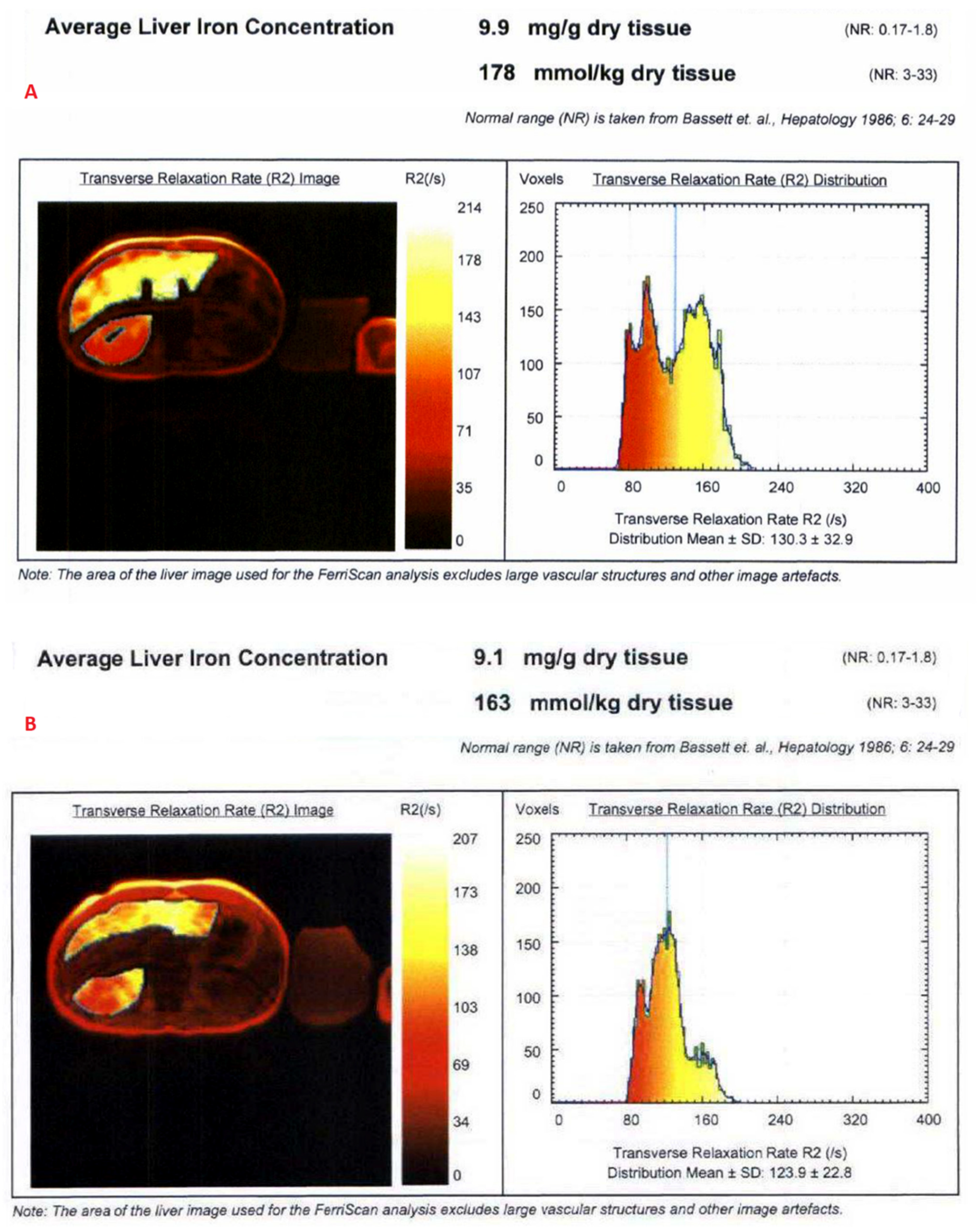 Tomography 08 00209 g001a Tomography 08 00209 g001a