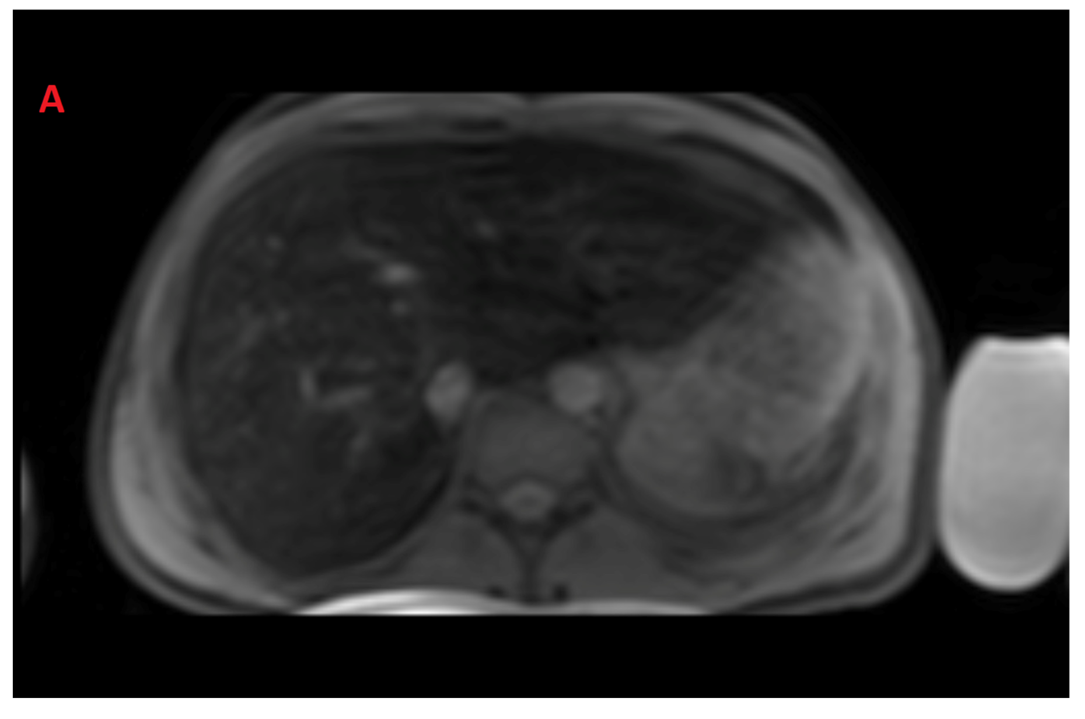 Tomography 08 00209 g002a Tomography 08 00209 g002a