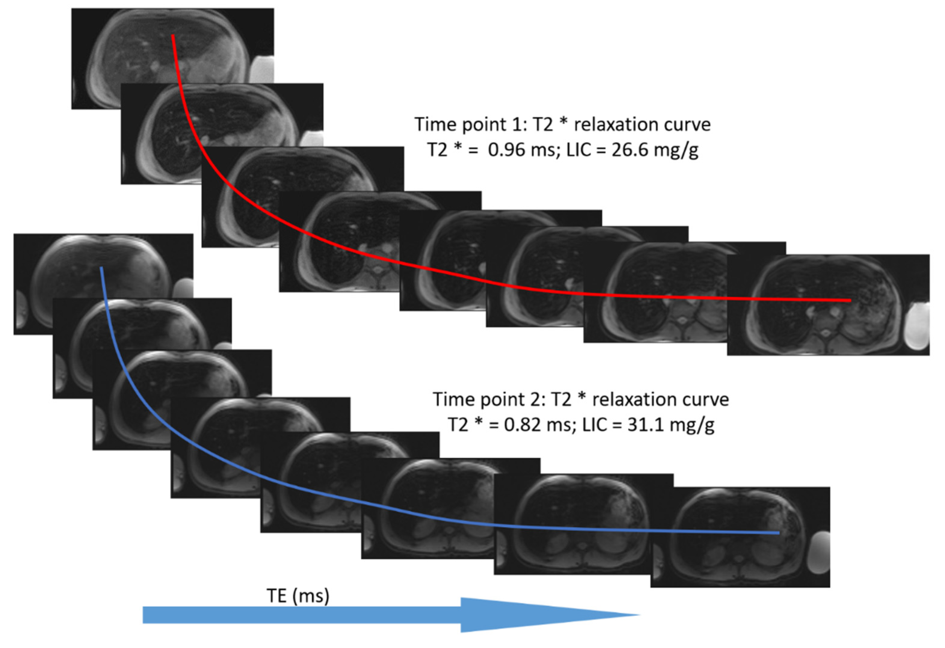 Tomography 08 00209 g003 Tomography 08 00209 g003