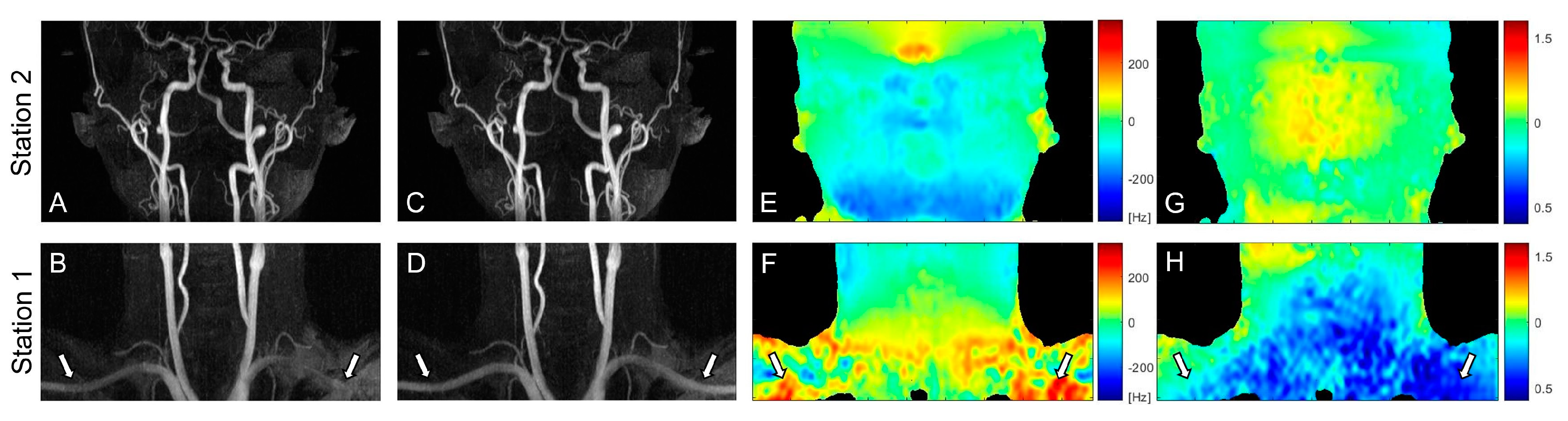 Tomography 09 00006 g003
