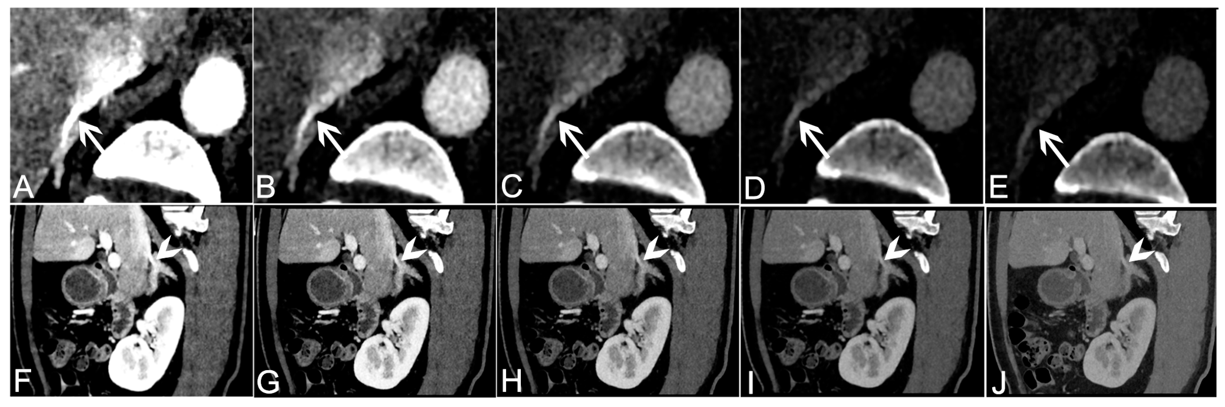 Tomography 09 00040 g002