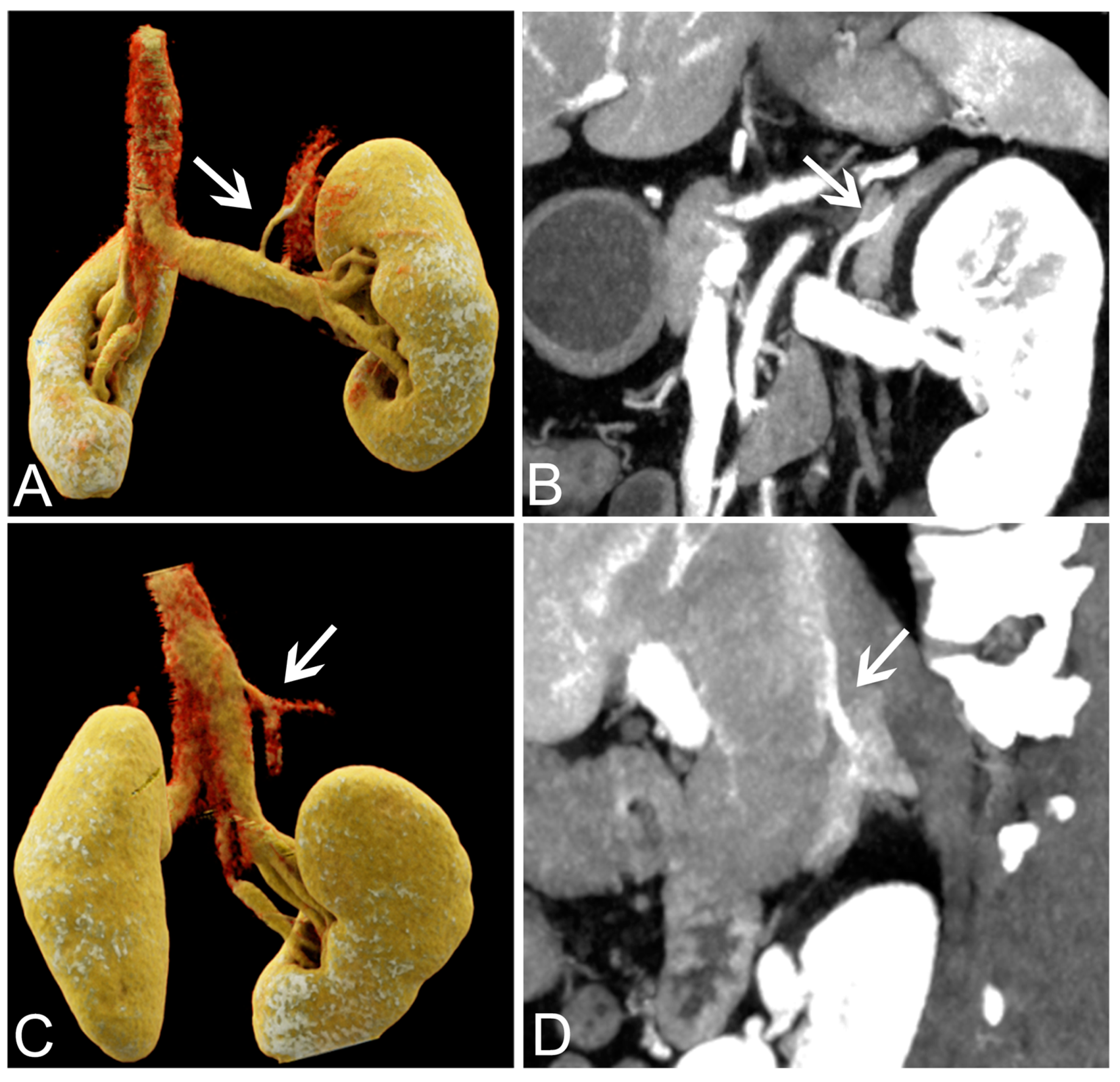Tomography 09 00040 g003