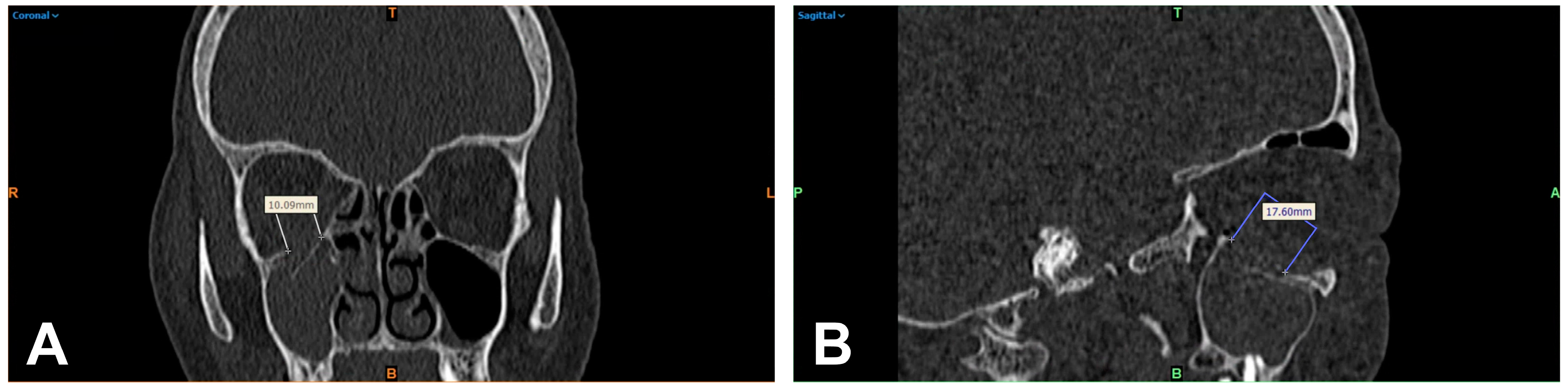 Tomography 09 00047 g001