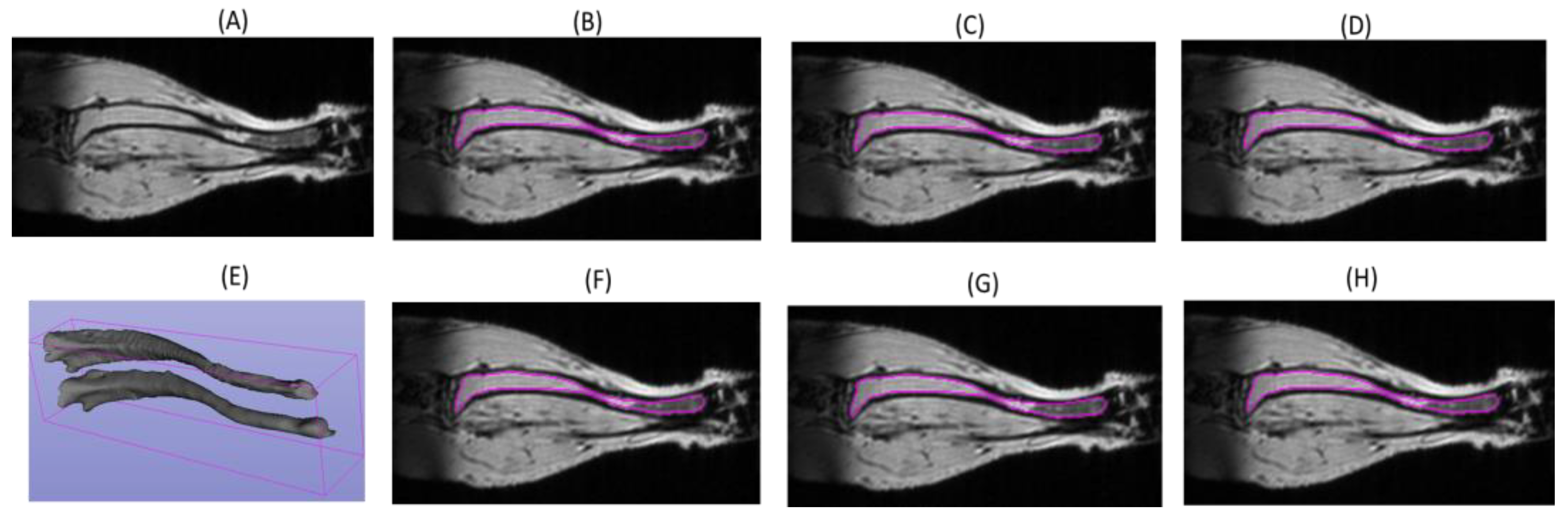 Deep learning-based segmentation of the thorax in mouse micro-CT scans