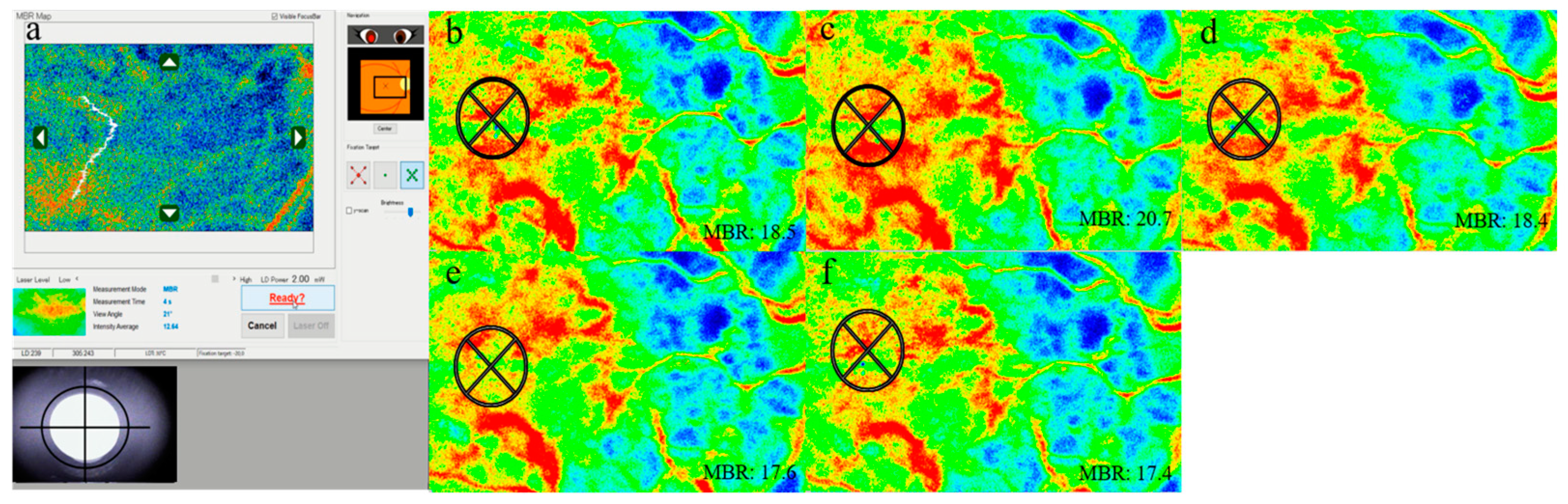 Tomography 09 00064 g001