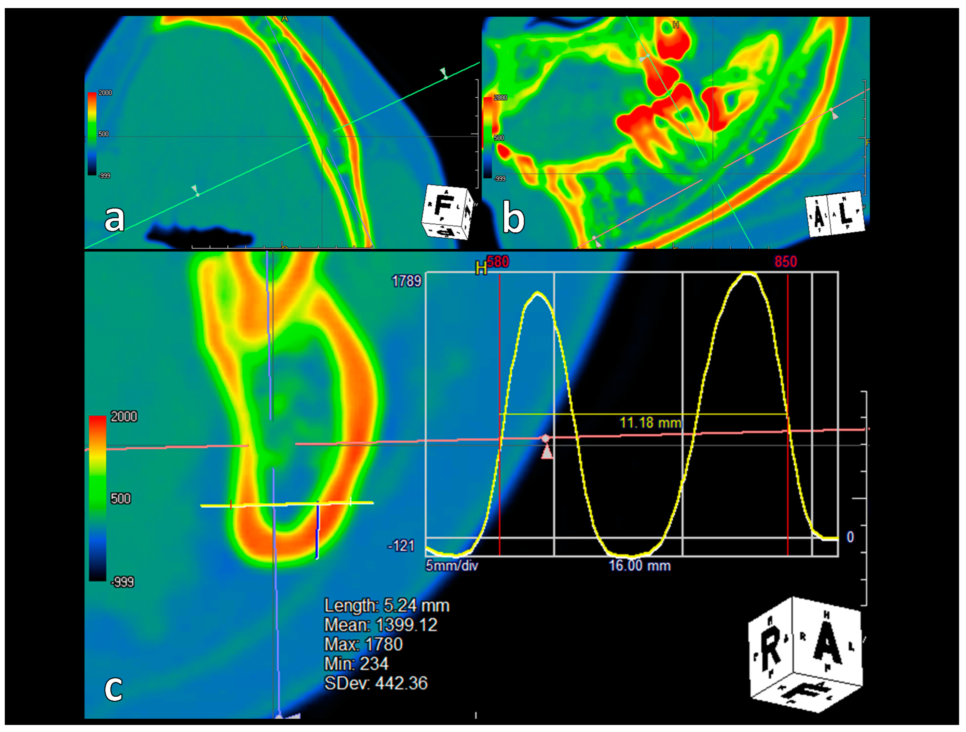 Tomography 09 00098 g002 Tomography 09 00098 g002