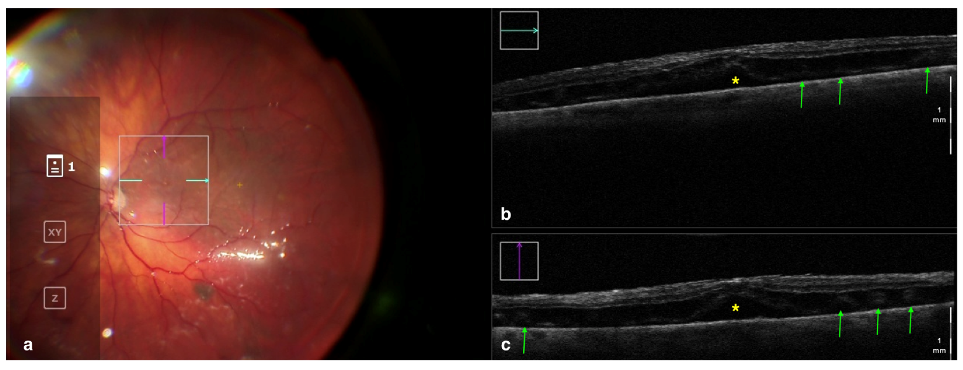 Tomography 09 00132 g003 Tomography 09 00132 g003