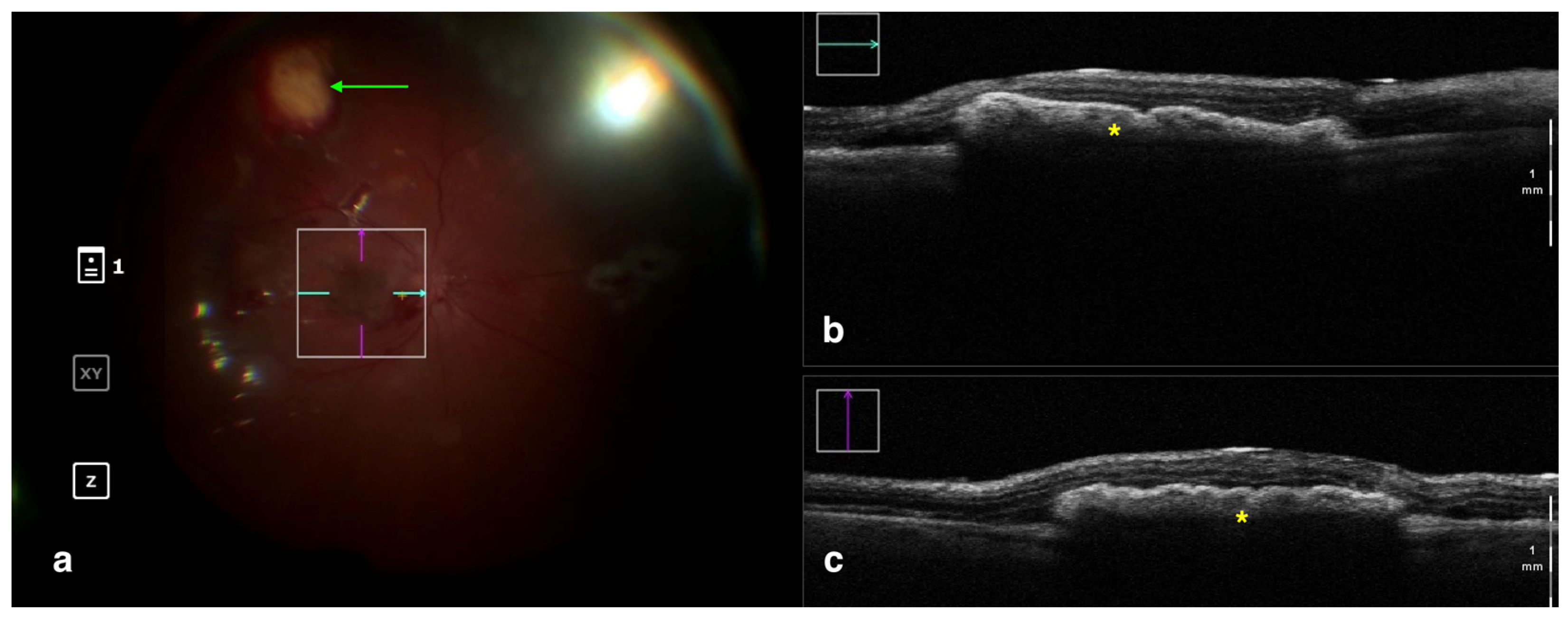 Tomography 09 00132 g004 Tomography 09 00132 g004