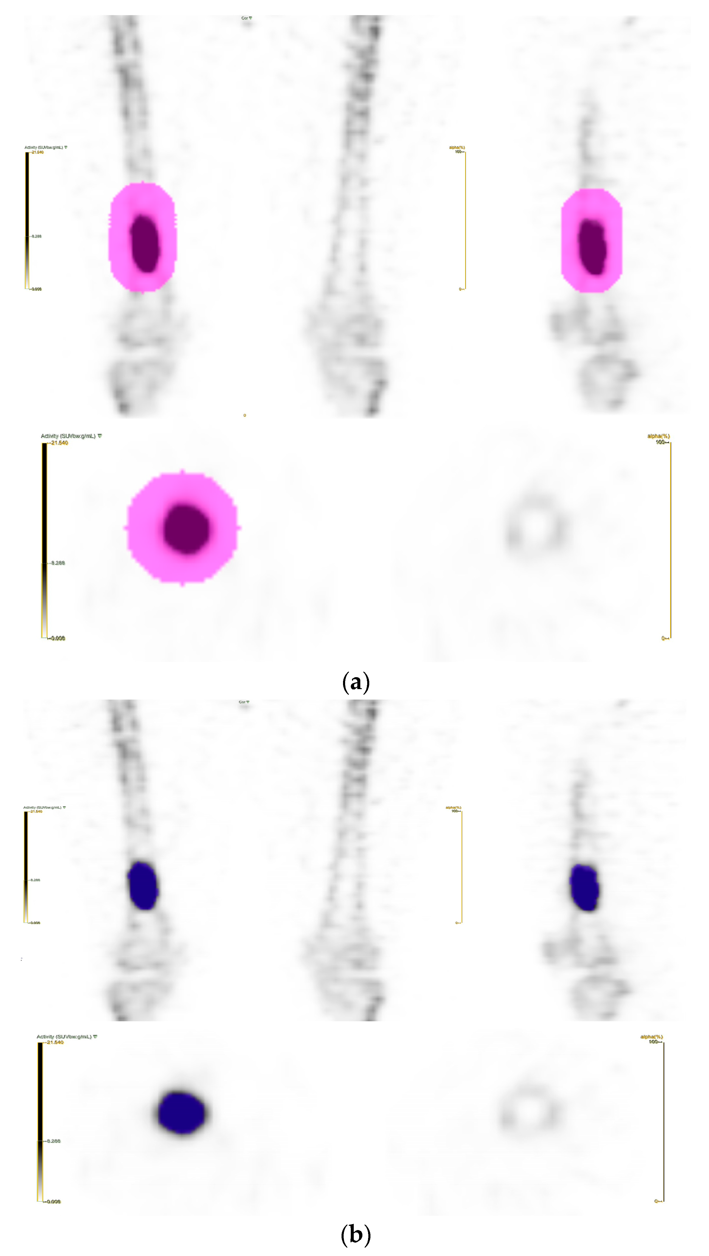 Tomography 09 00148 g001