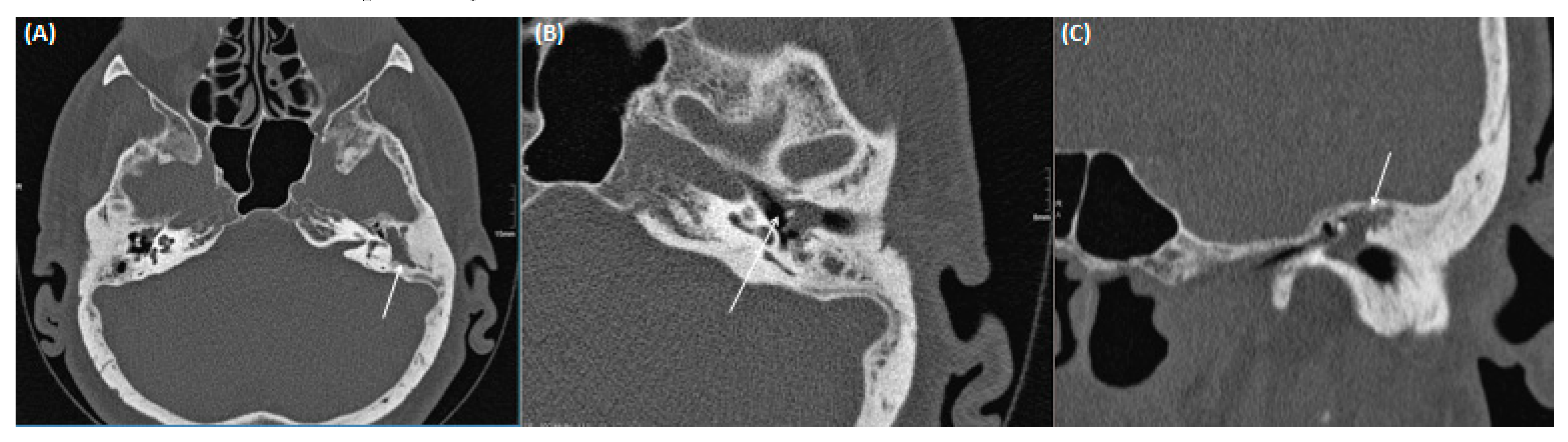 Tomography 09 00170 g014 Tomography 09 00170 g014