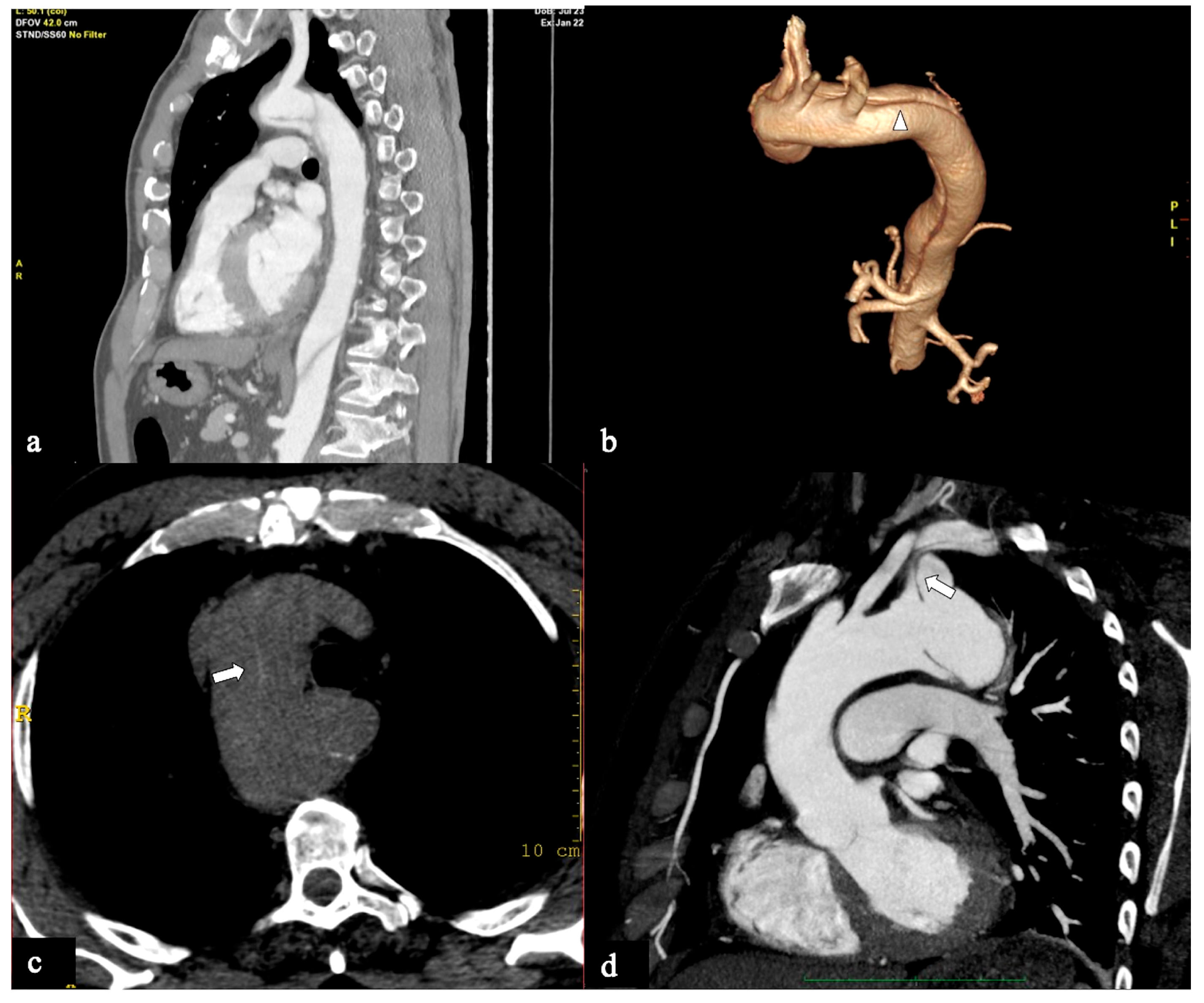 Tomography 09 00174 g003 Tomography 09 00174 g003