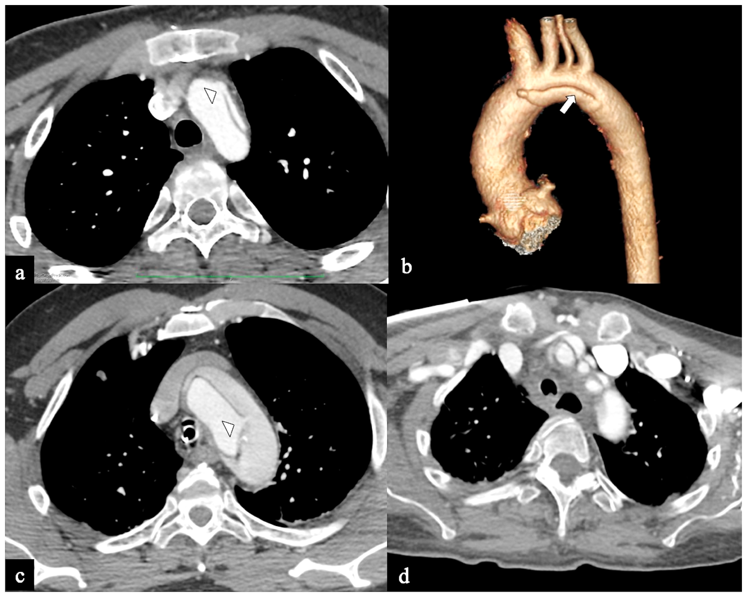 Tomography 09 00174 g004 Tomography 09 00174 g004