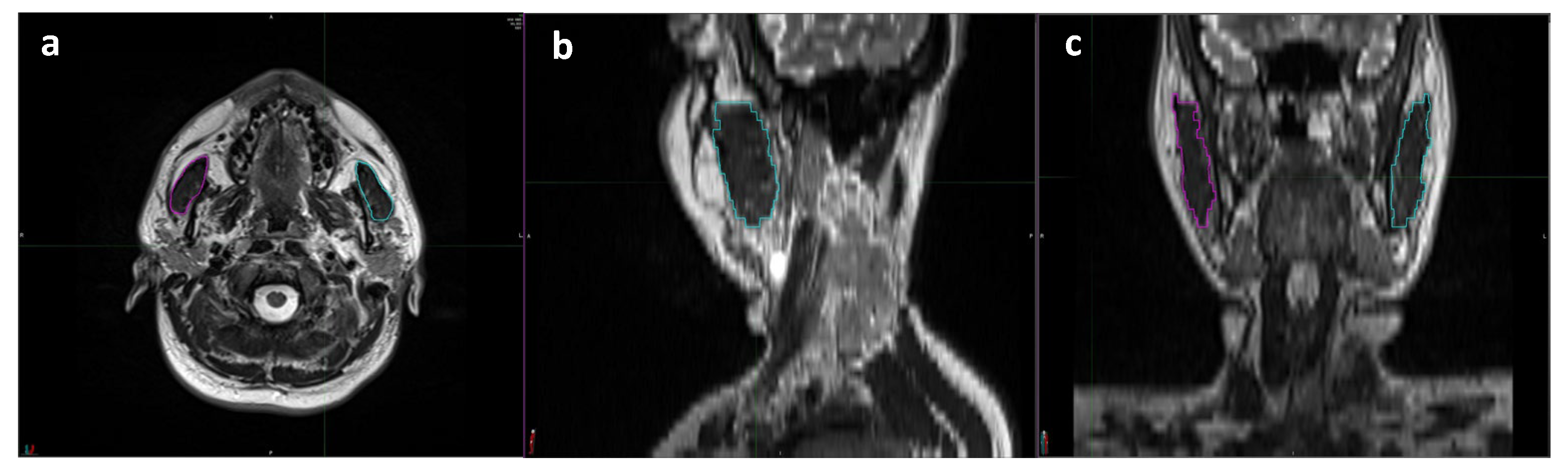 Tomography 10 00007 g001