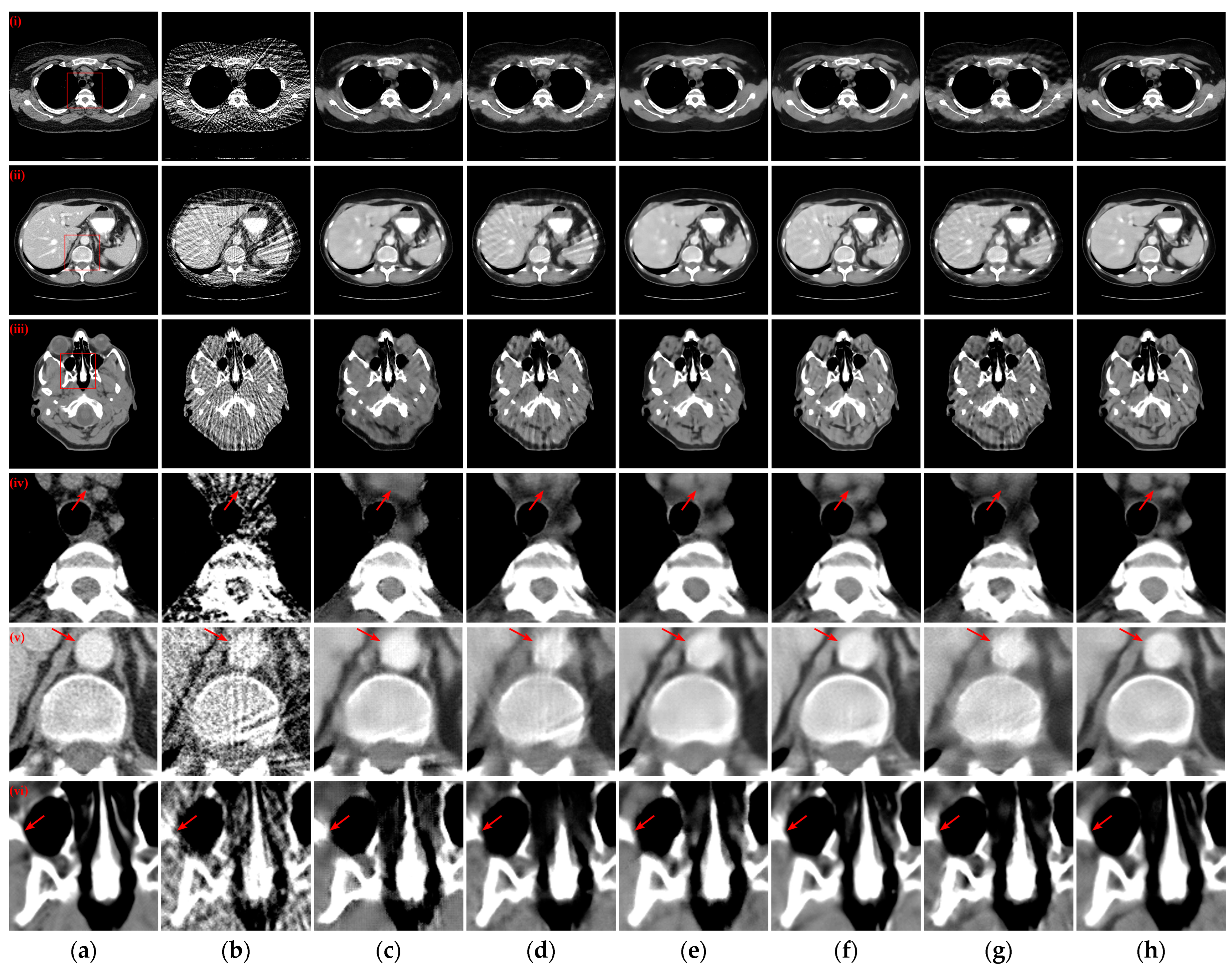 Tomography 10 00011 g005