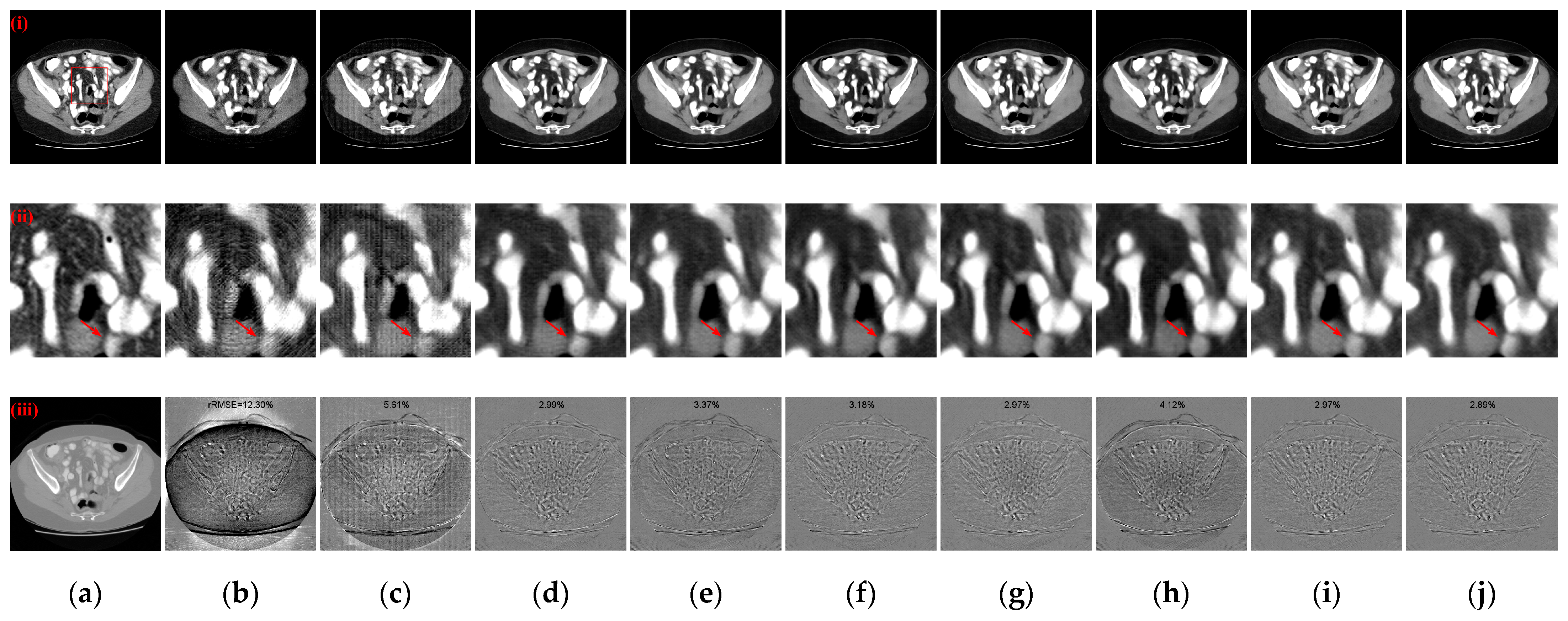 Tomography 10 00011 g011