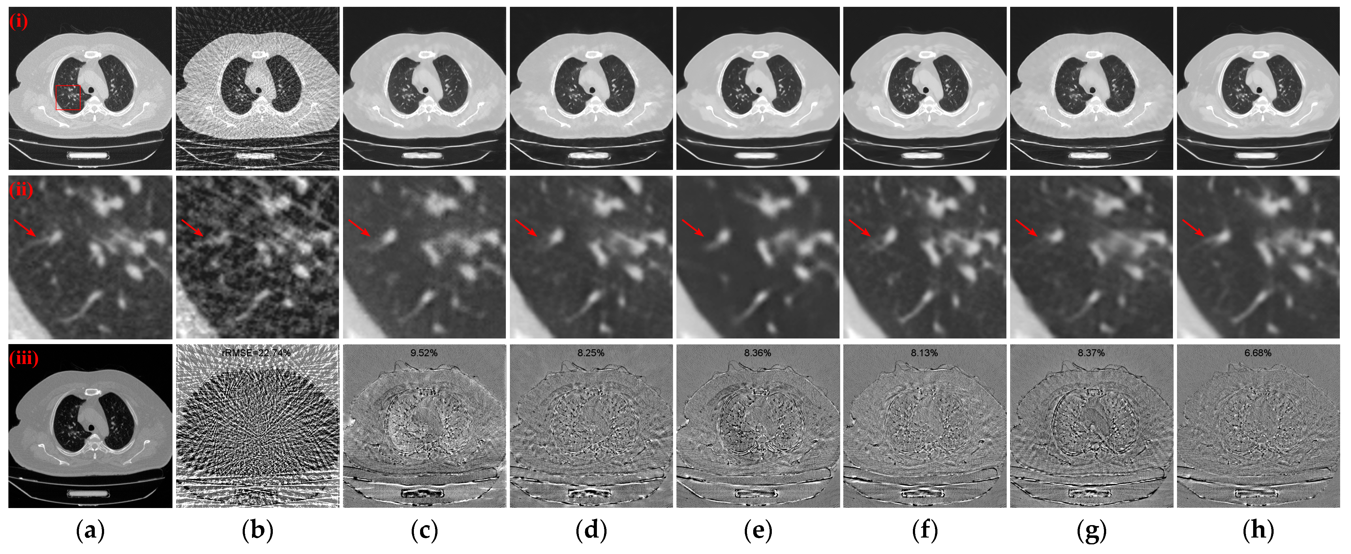 Tomography 10 00011 g013