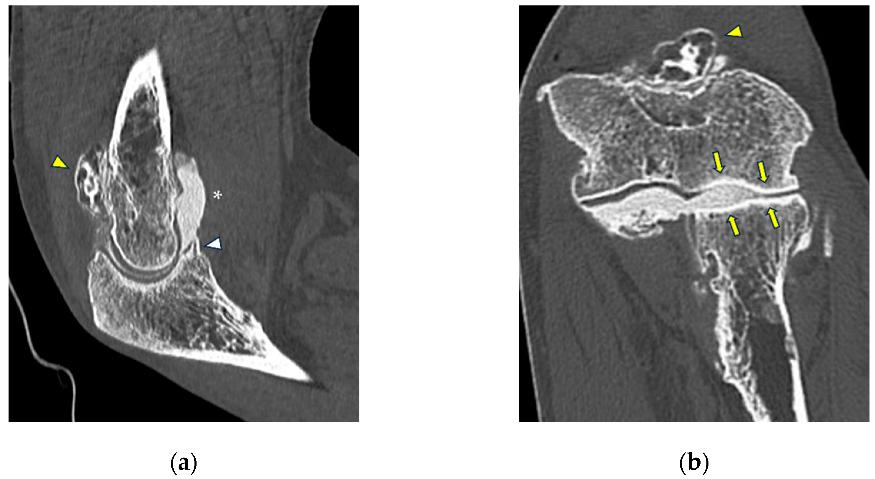 Tomography 10 00032 g004