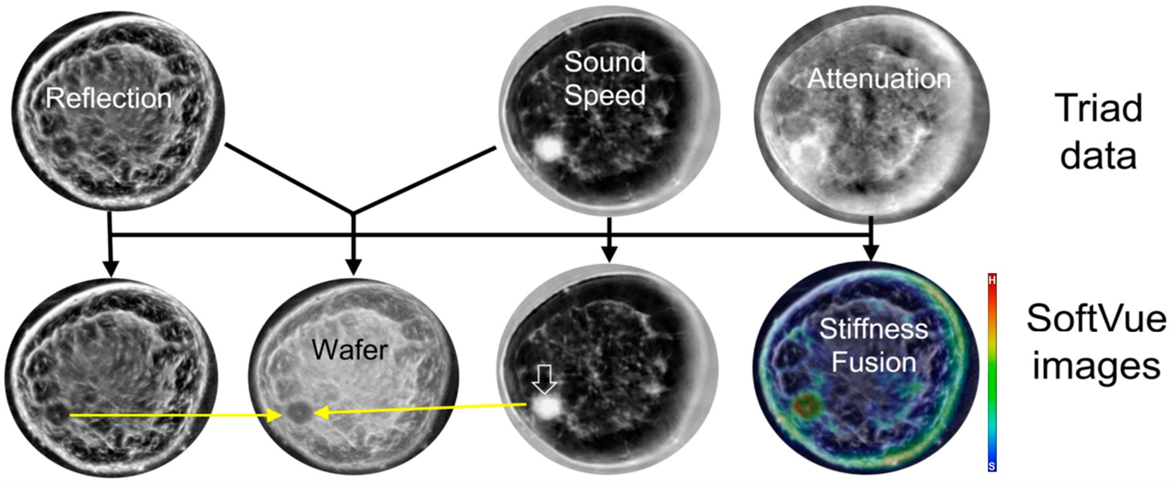 Tomography 10 00044 g002