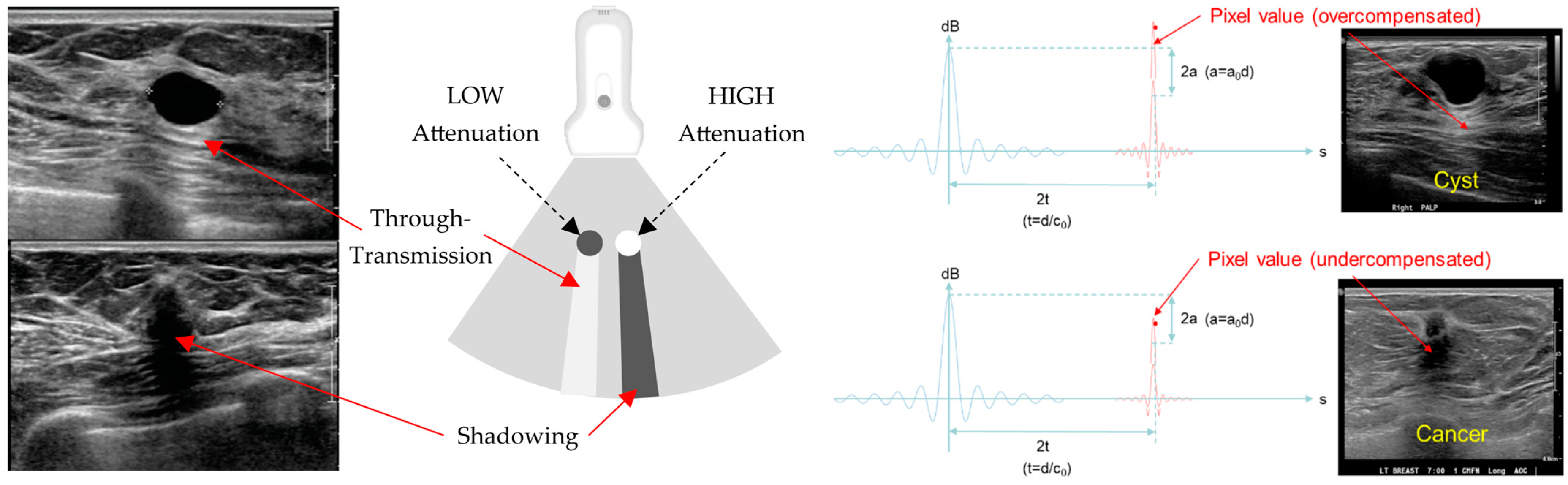 Tomography 10 00044 g003