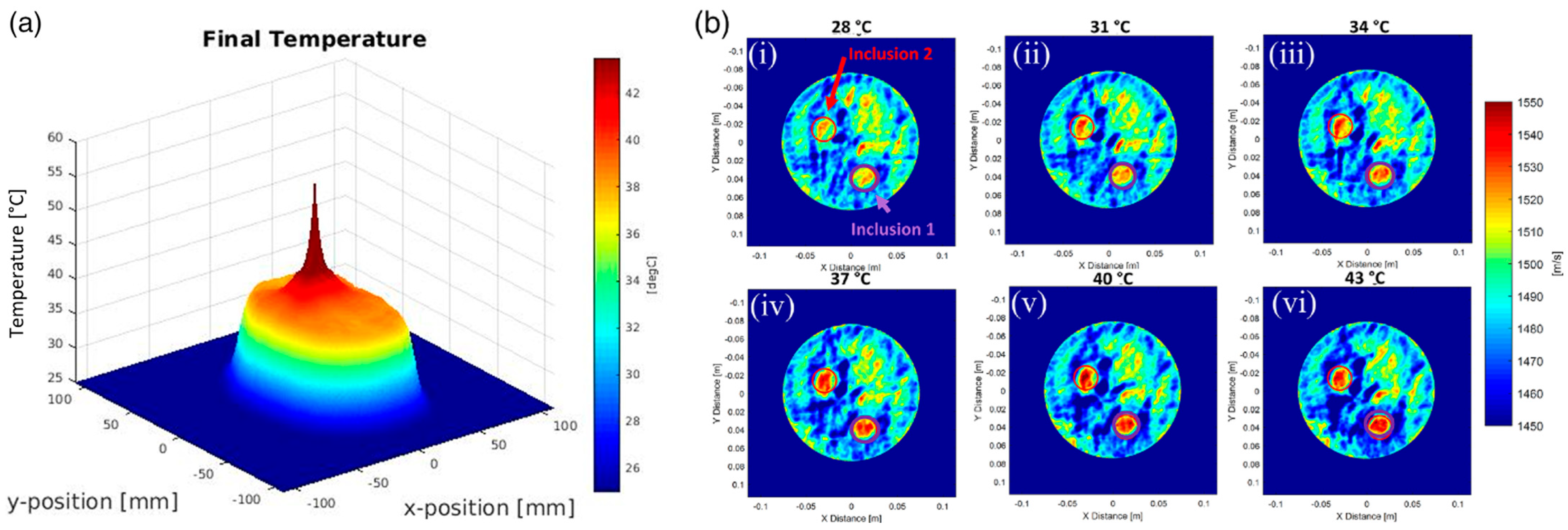 Tomography 10 00044 g011