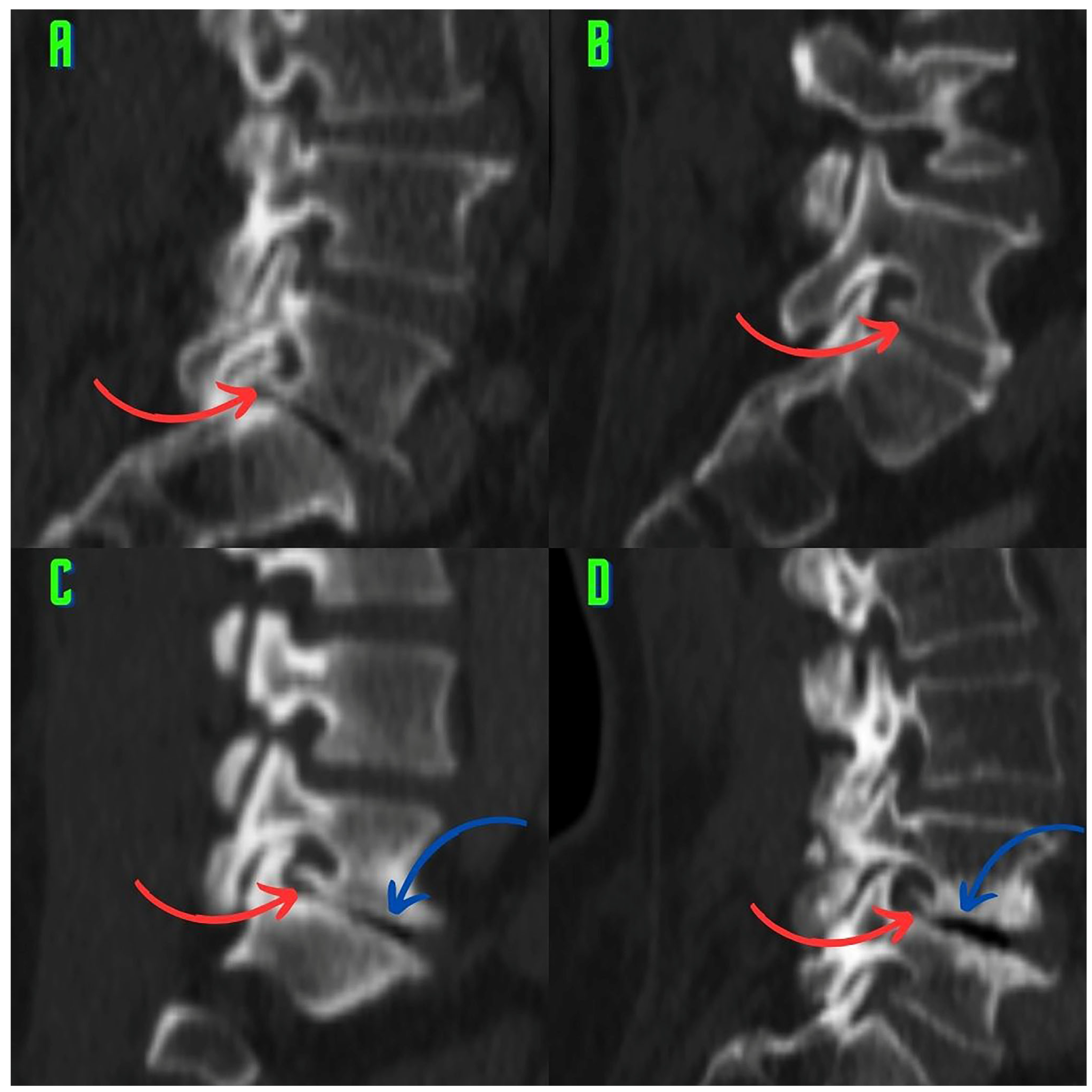Tomography 10 00047 g002