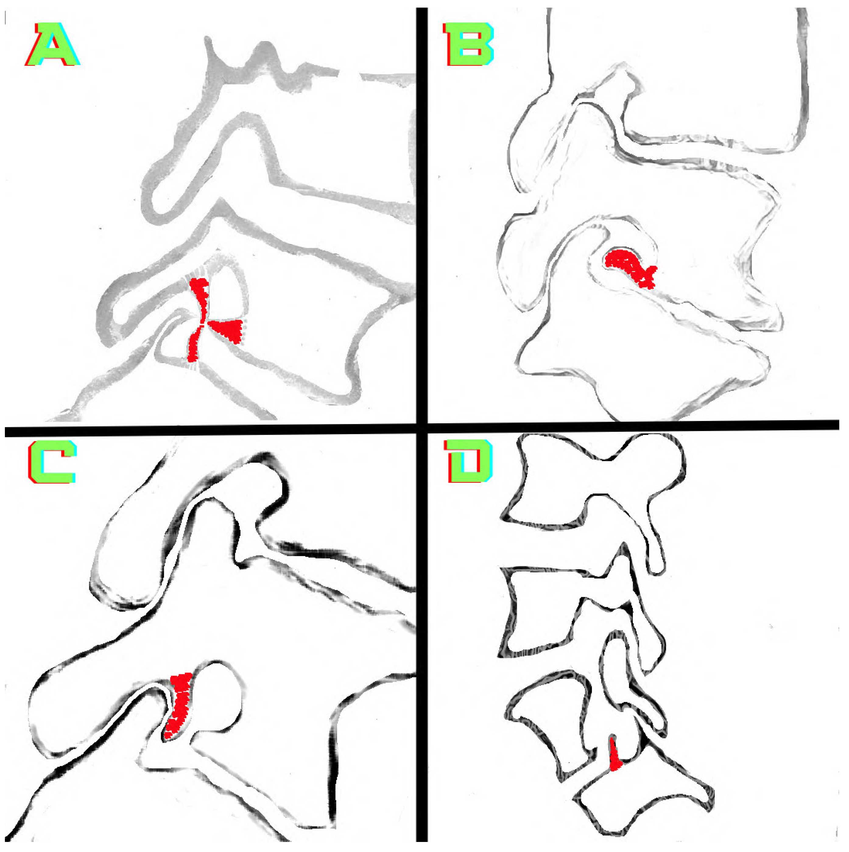 Tomography 10 00047 g004