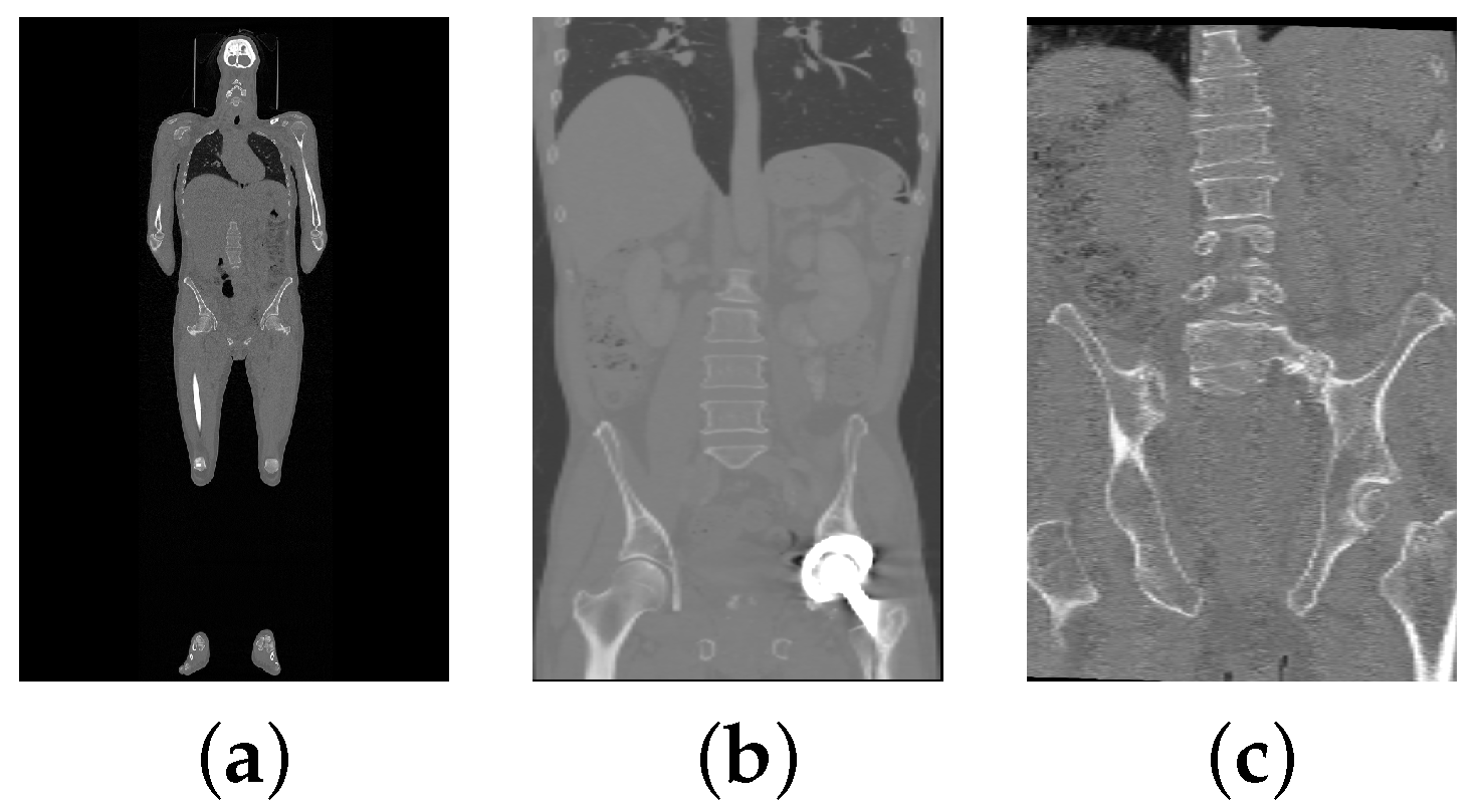 Tomography 10 00057 g007