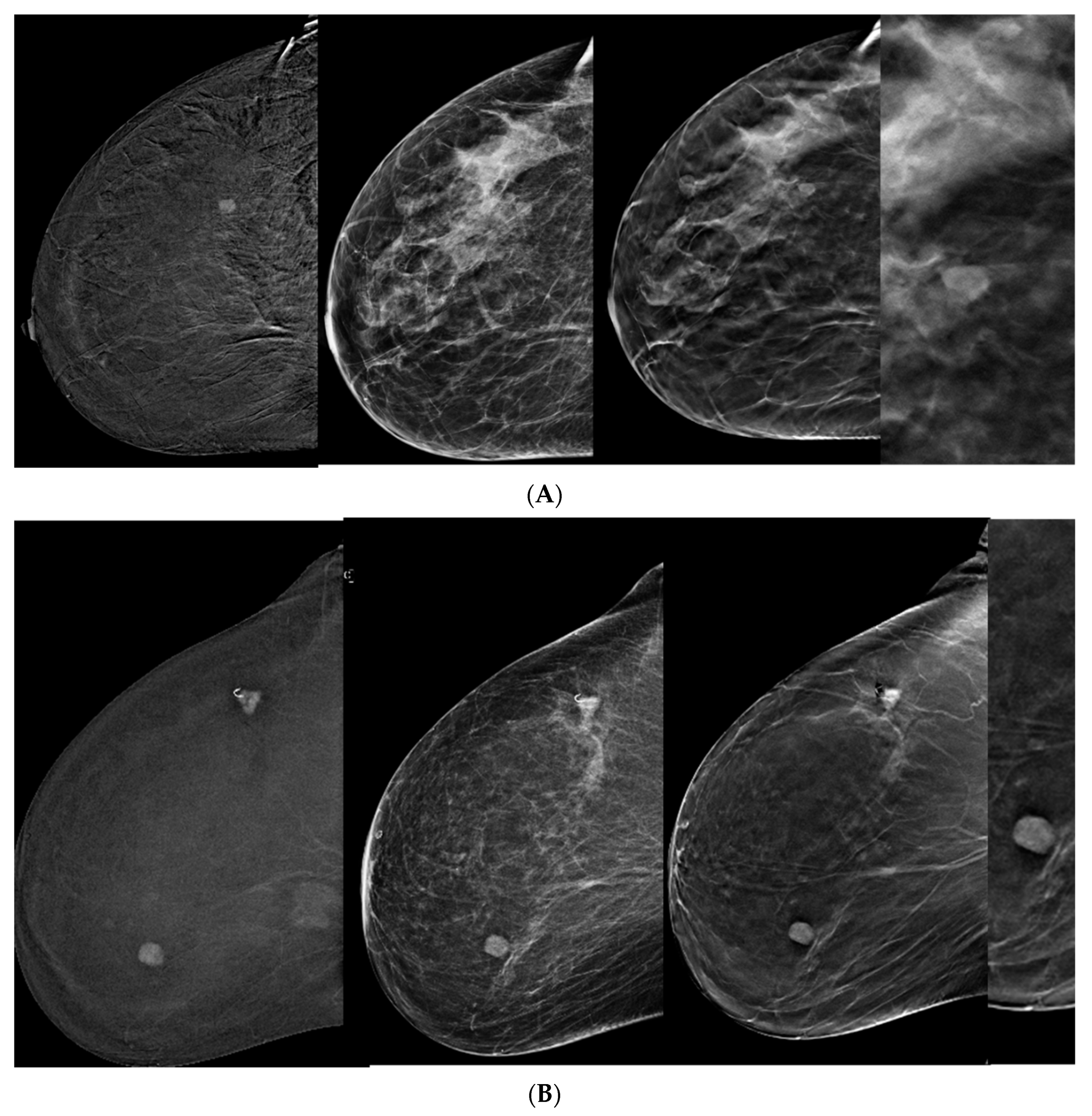 Tomography 10 00061 g002a