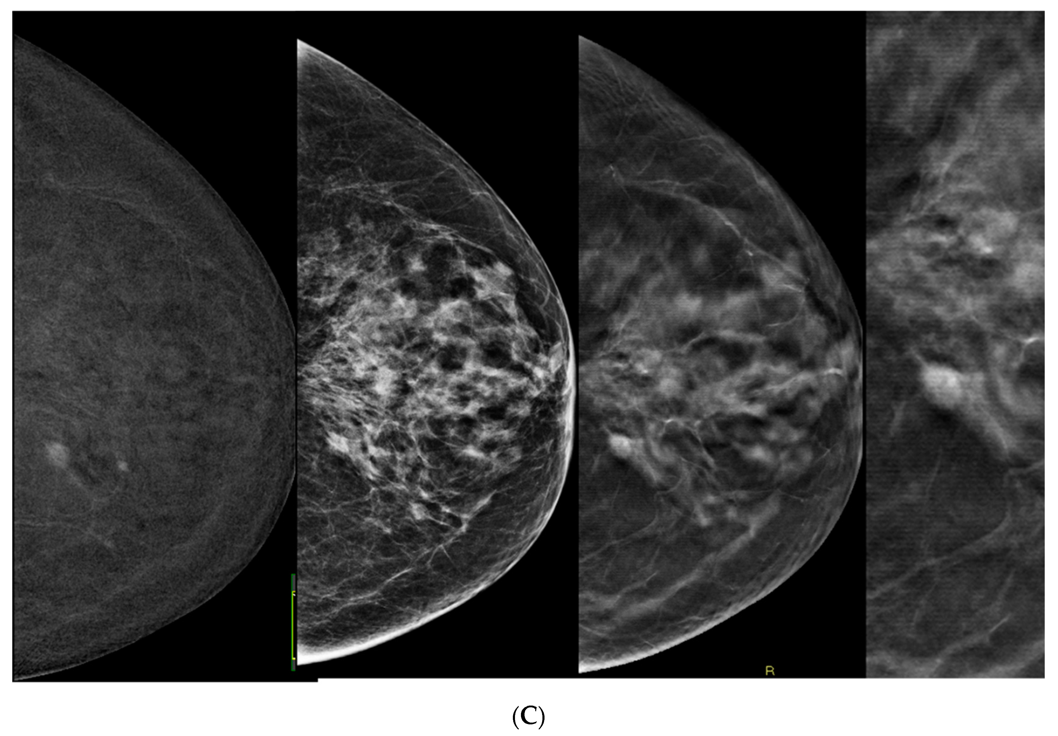 Tomography 10 00061 g002b