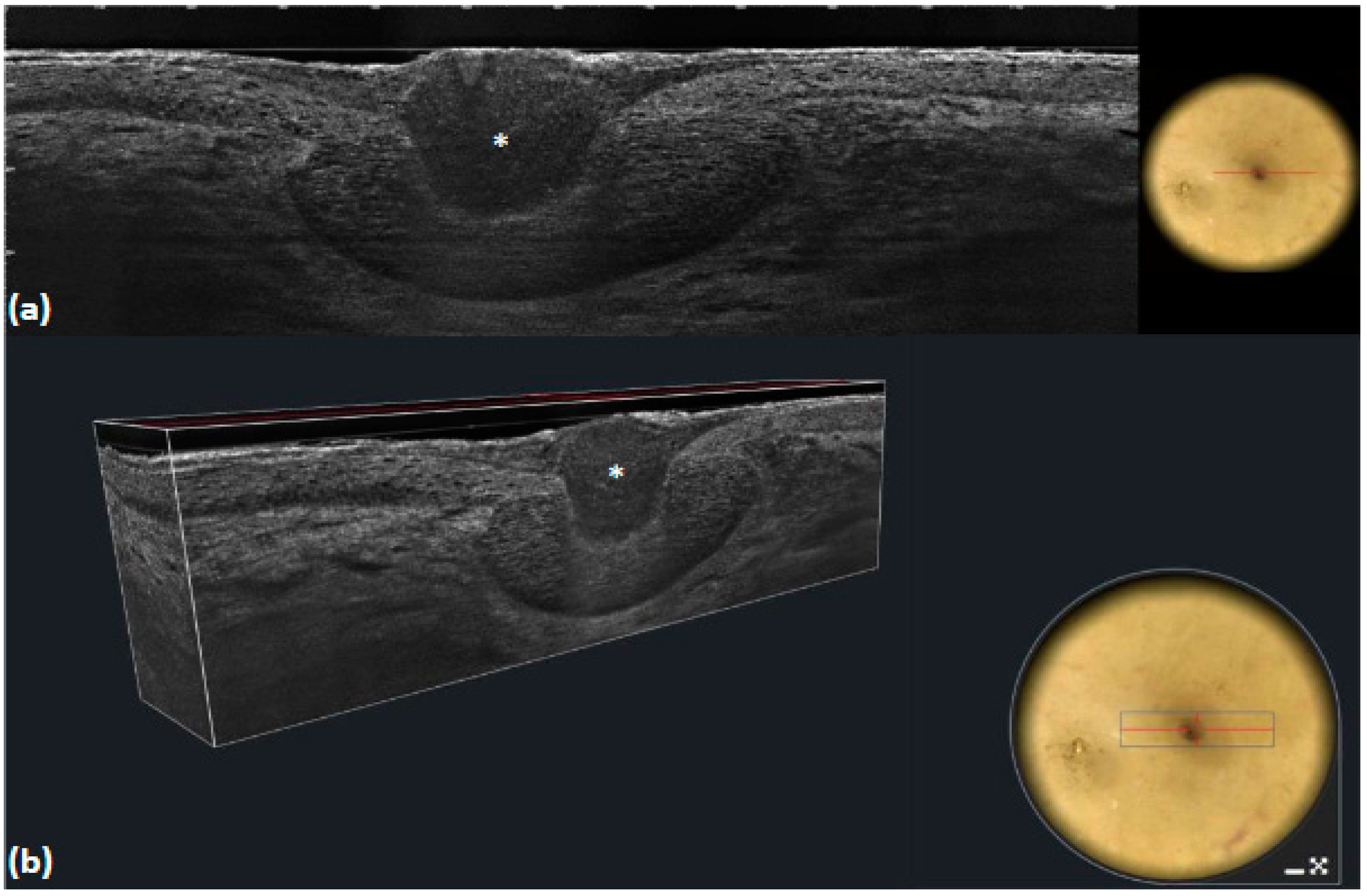 Tomography 10 00063 g006