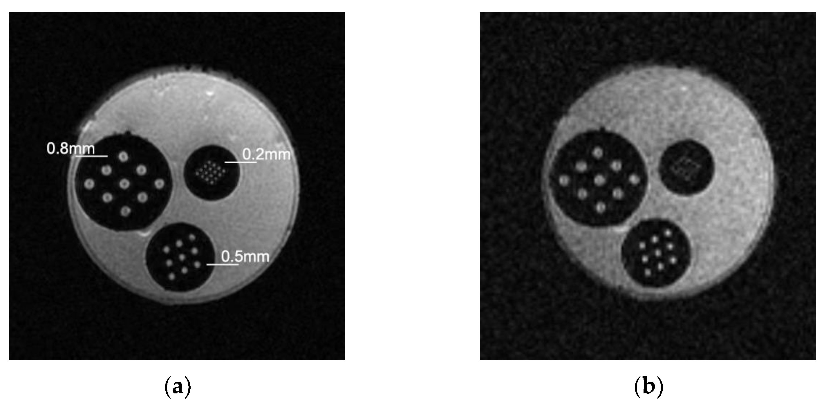 Tomography 10 00064 g003